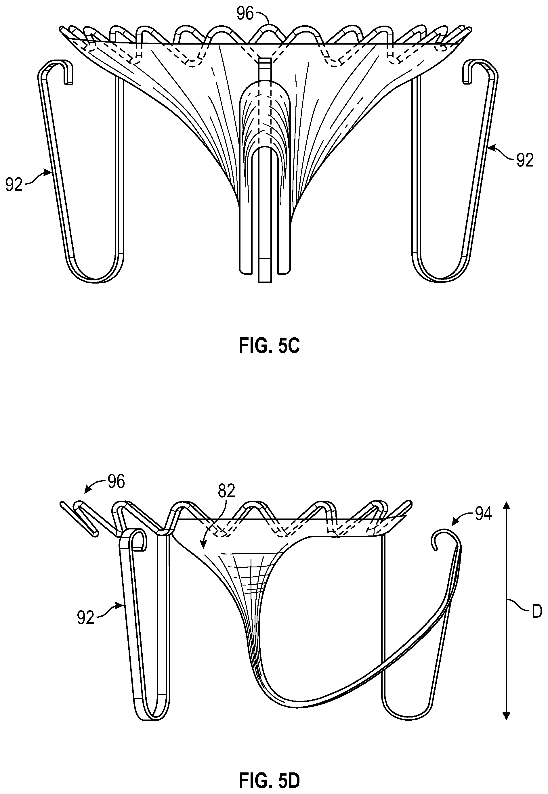 Patent US12350153 Figure 8 – Systems and methods for transcatheter treatment of valve regurgitation