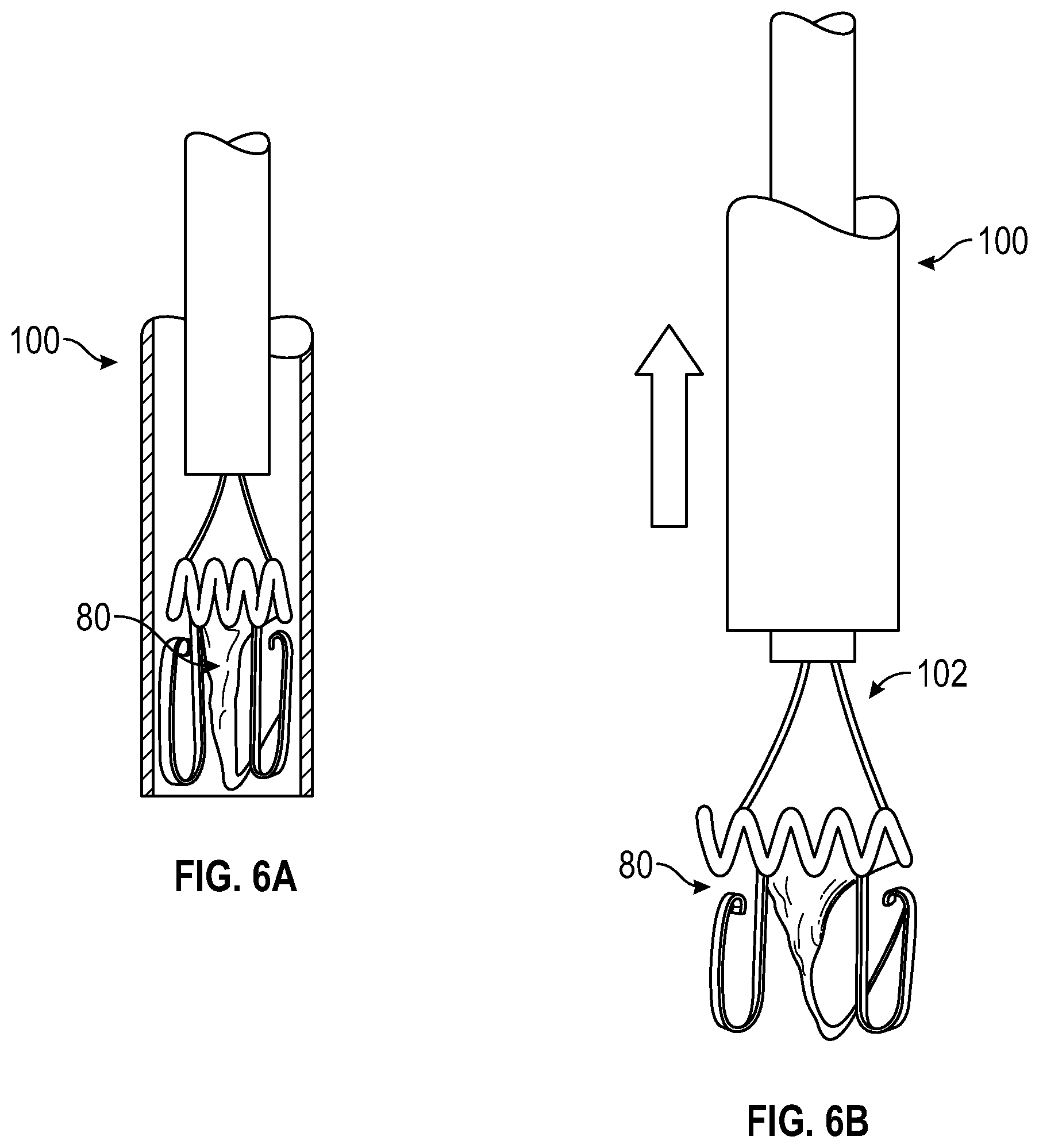 Patent US12350153 Figure 9 – Systems and methods for transcatheter treatment of valve regurgitation