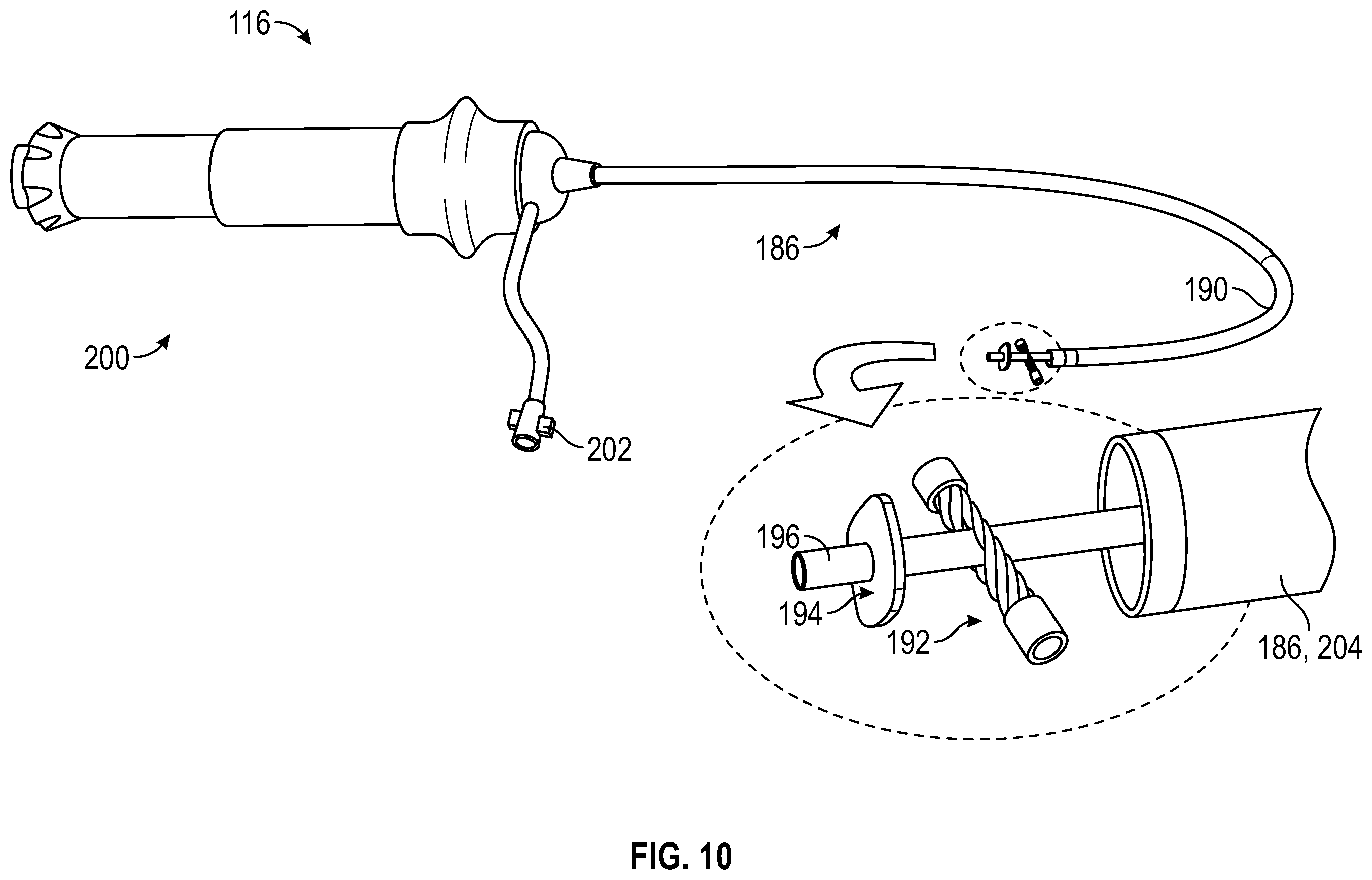 Patent US12350153 Figure 14 – Systems and methods for transcatheter treatment of valve regurgitation