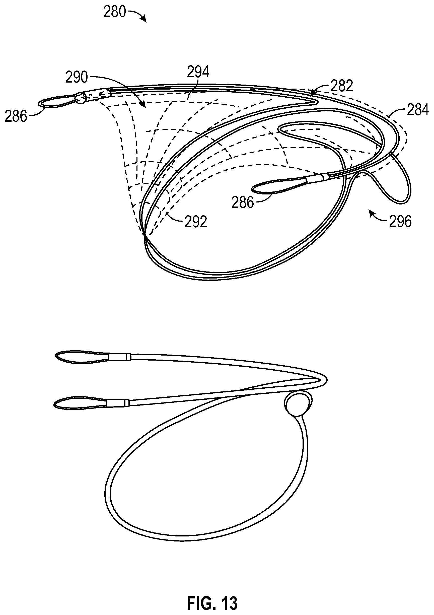 Patent US12350153 Figure 20 – Systems and methods for transcatheter treatment of valve regurgitation
