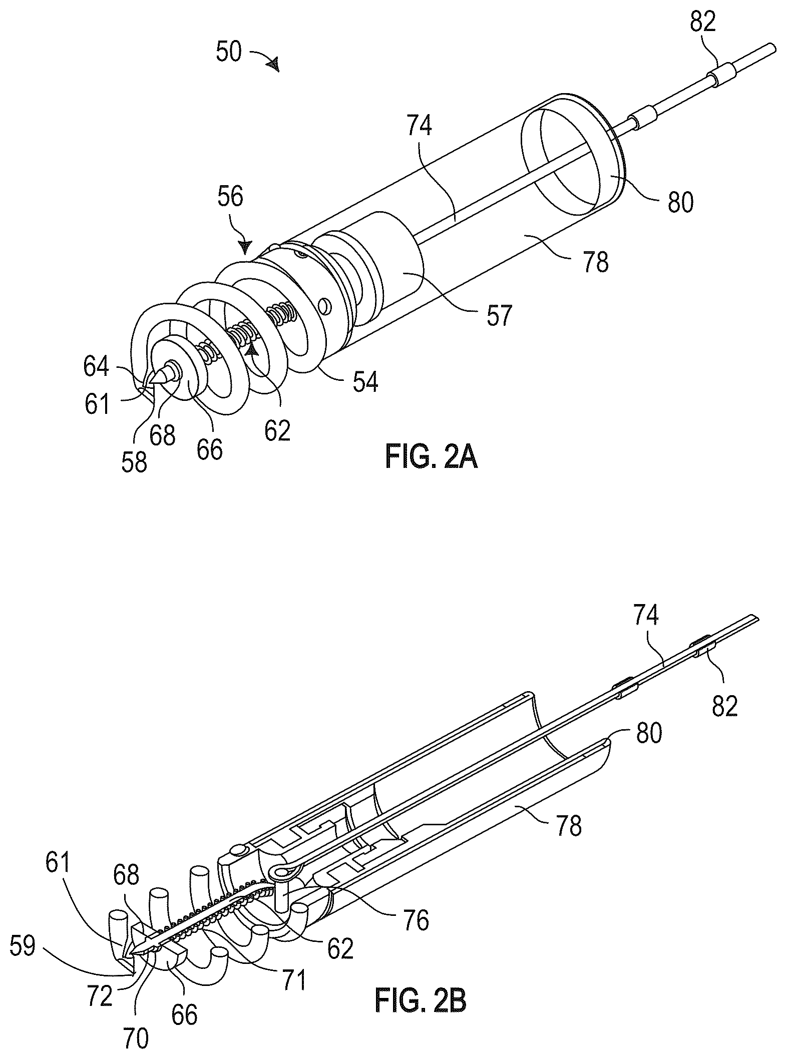 Patent US12350155 Figure 2 – Method and apparatus for mitral valve chord repair