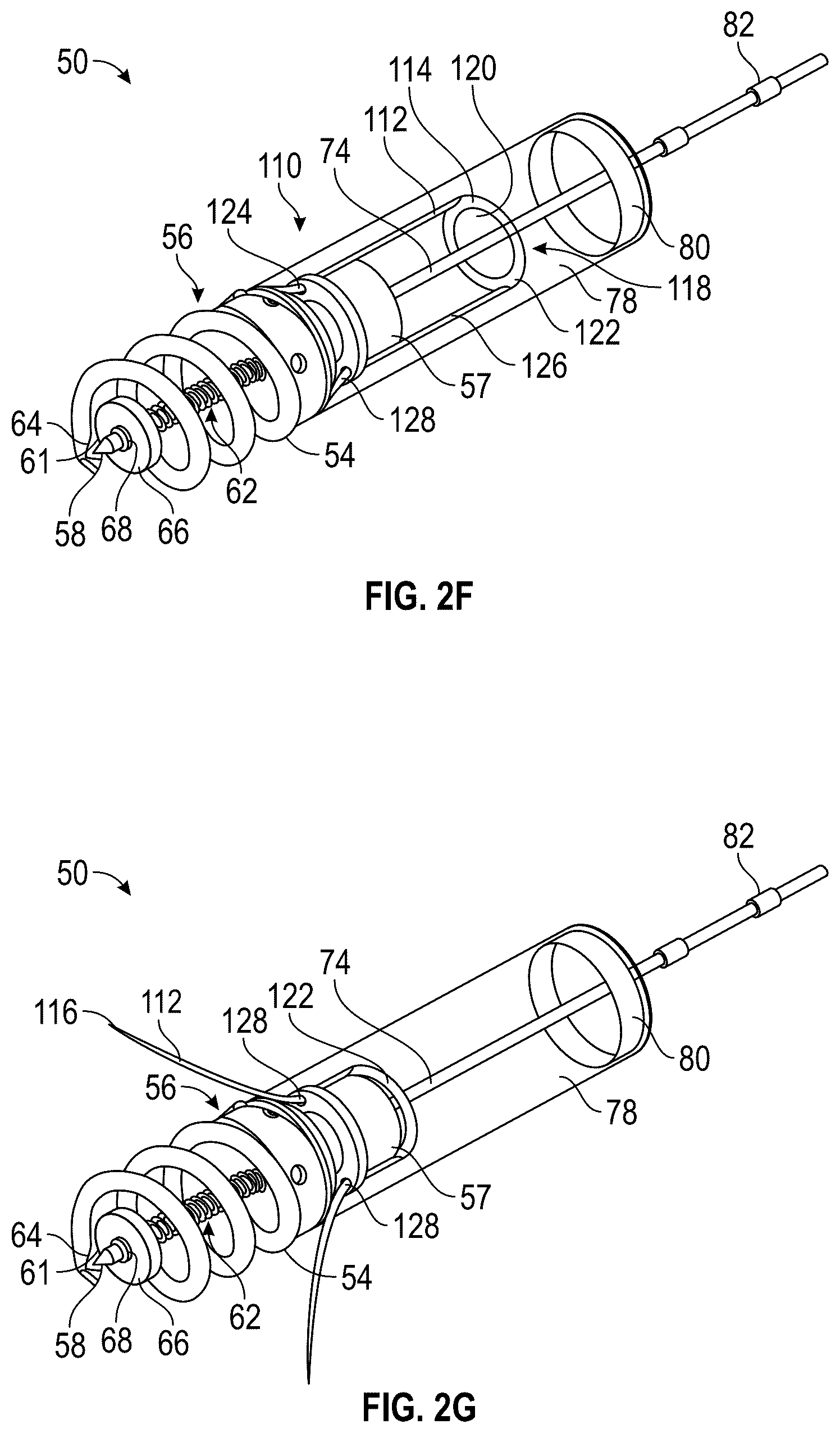Patent US12350155 Figure 5 – Method and apparatus for mitral valve chord repair