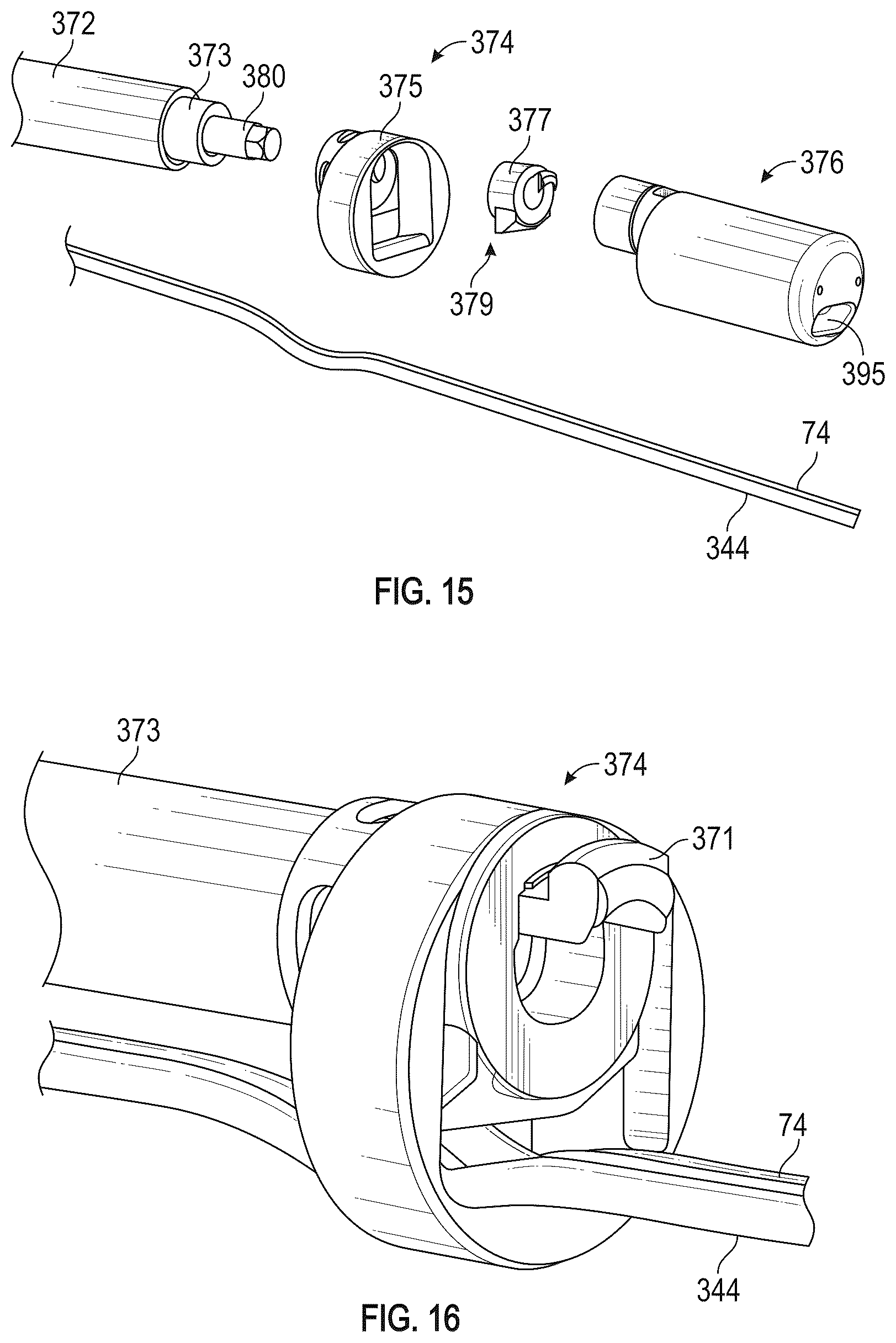 Patent US12350155 Figure 17 – Method and apparatus for mitral valve chord repair
