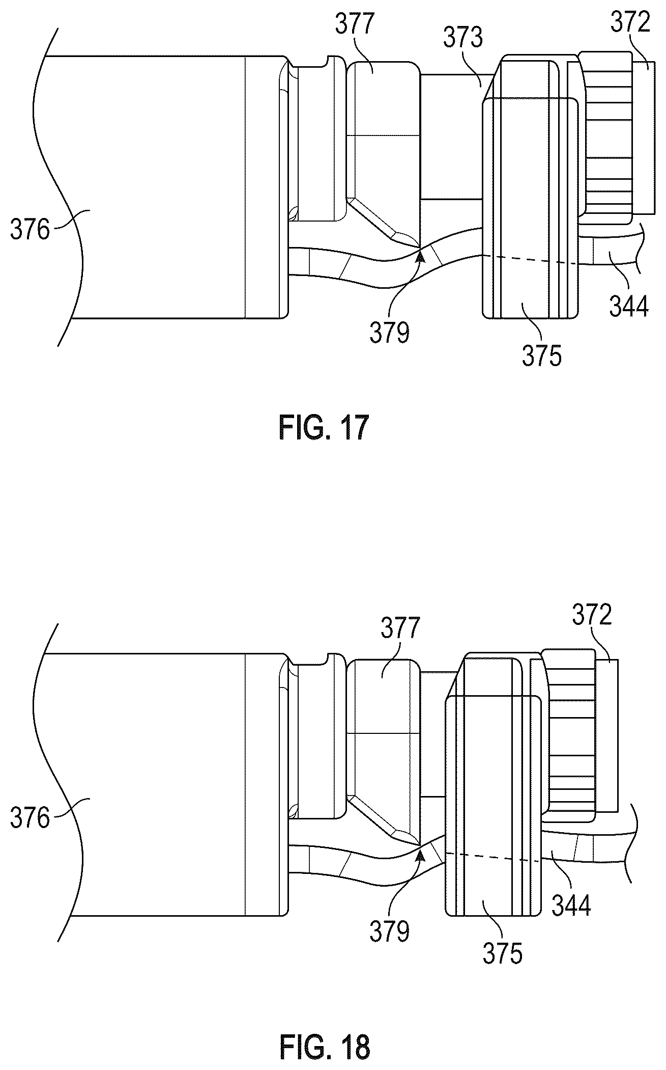 Patent US12350155 Figure 18 – Method and apparatus for mitral valve chord repair