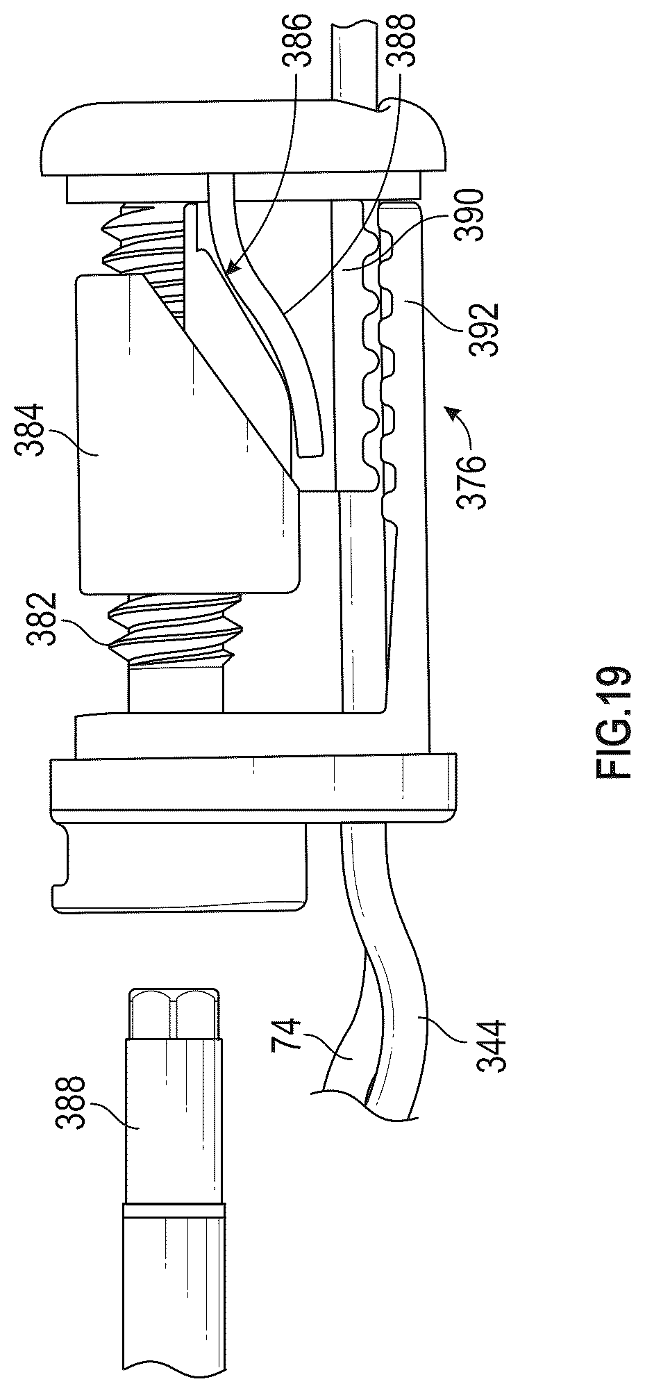 Patent US12350155 Figure 19 – Method and apparatus for mitral valve chord repair