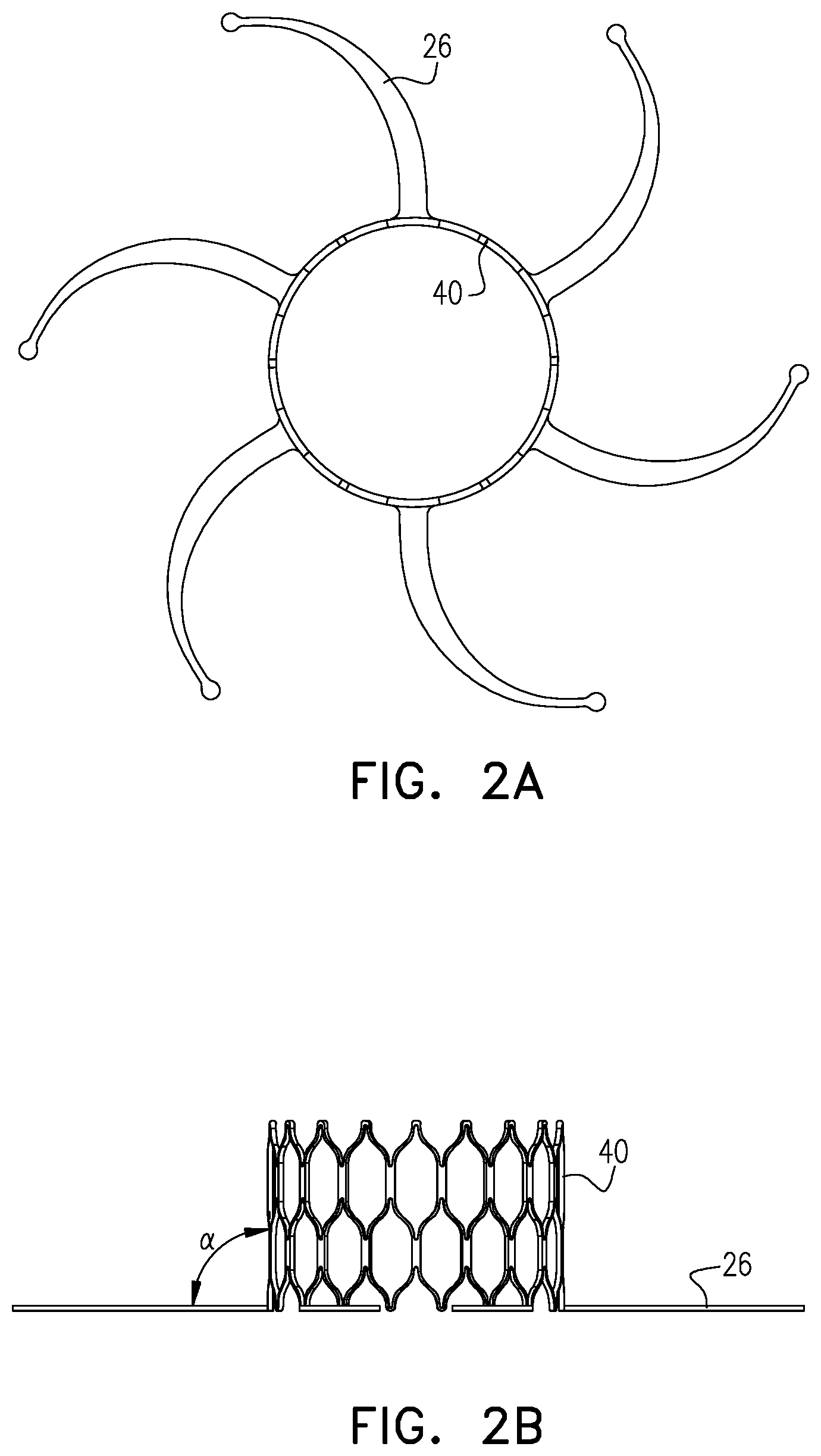 Patent US12350156 Figure 6 – Atrioventricular valve repair