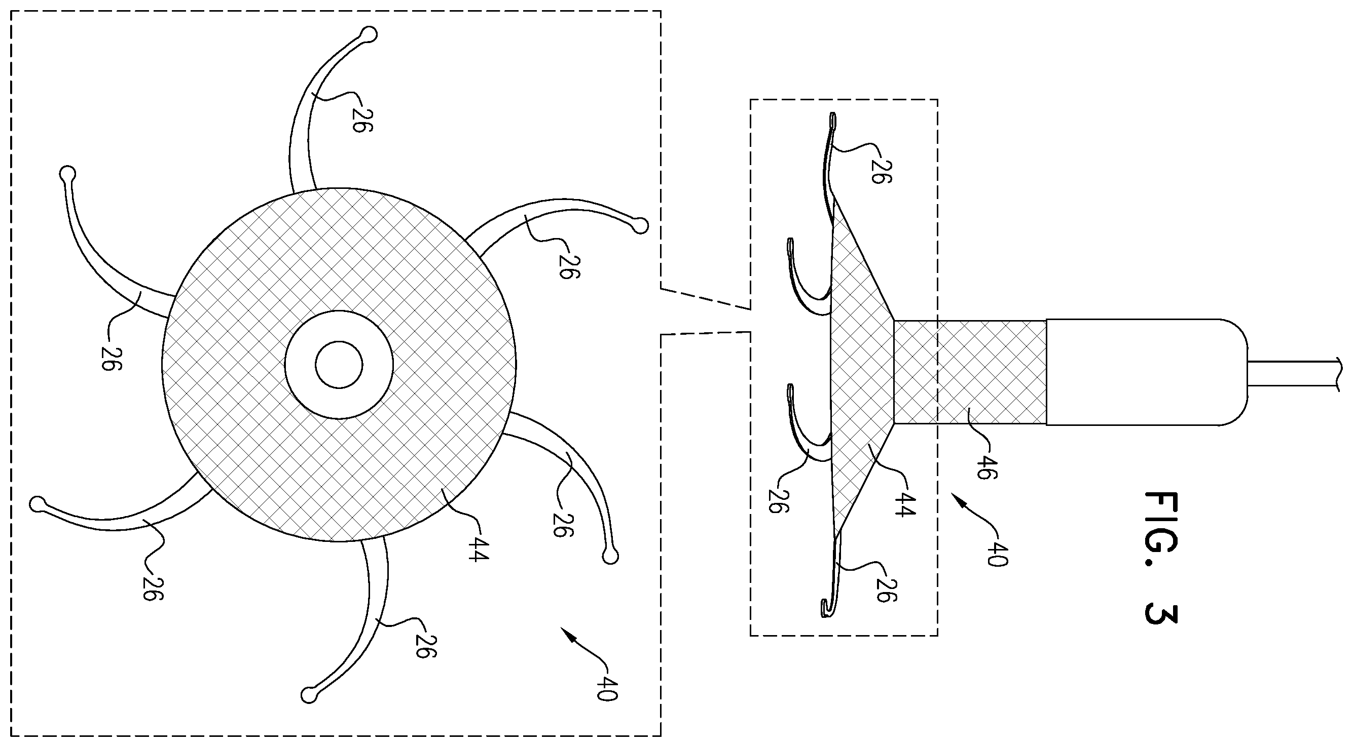 Patent US12350156 Figure 7 – Atrioventricular valve repair
