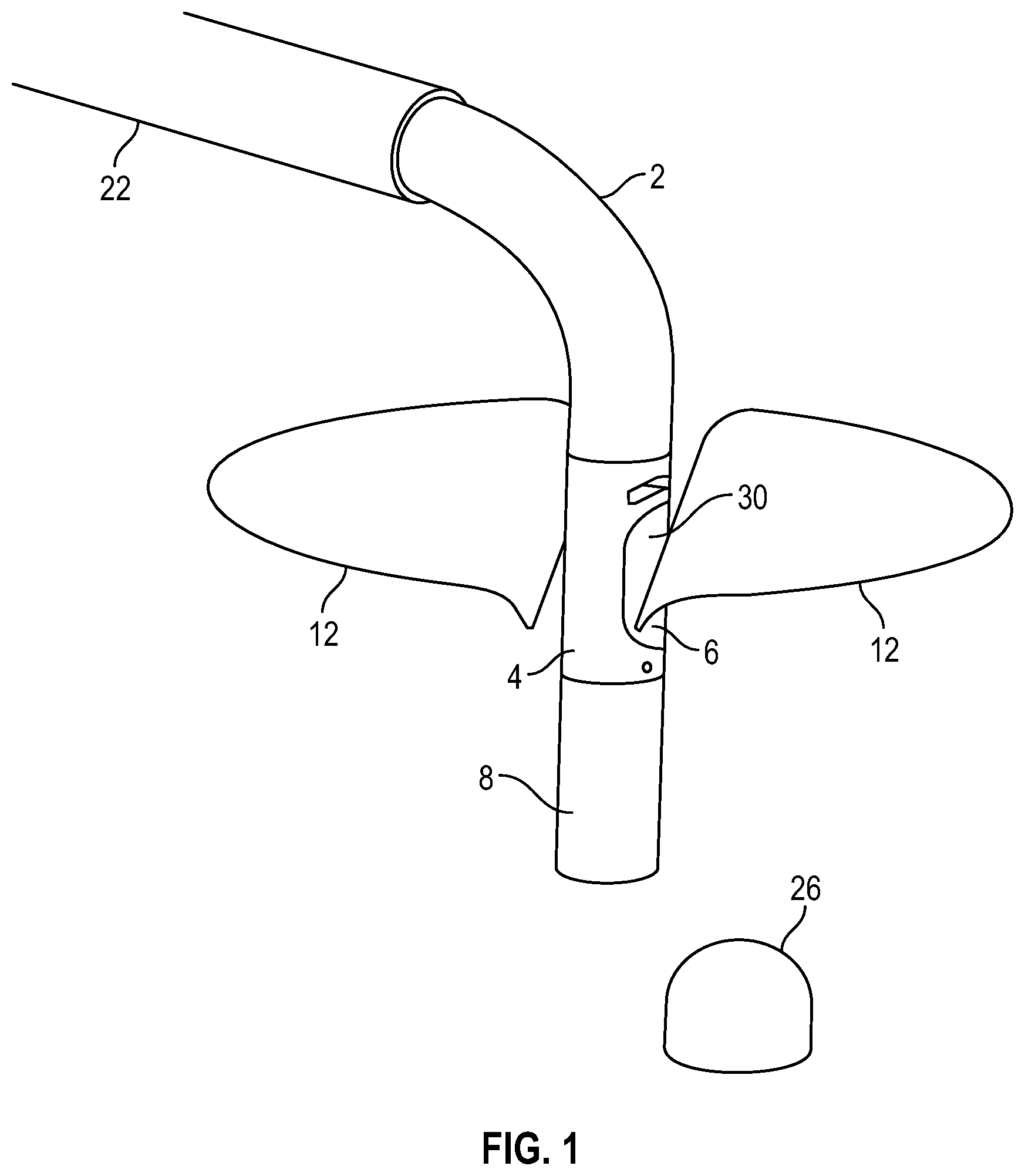 Patent US12350157 Figure 1 – Device for heart repair