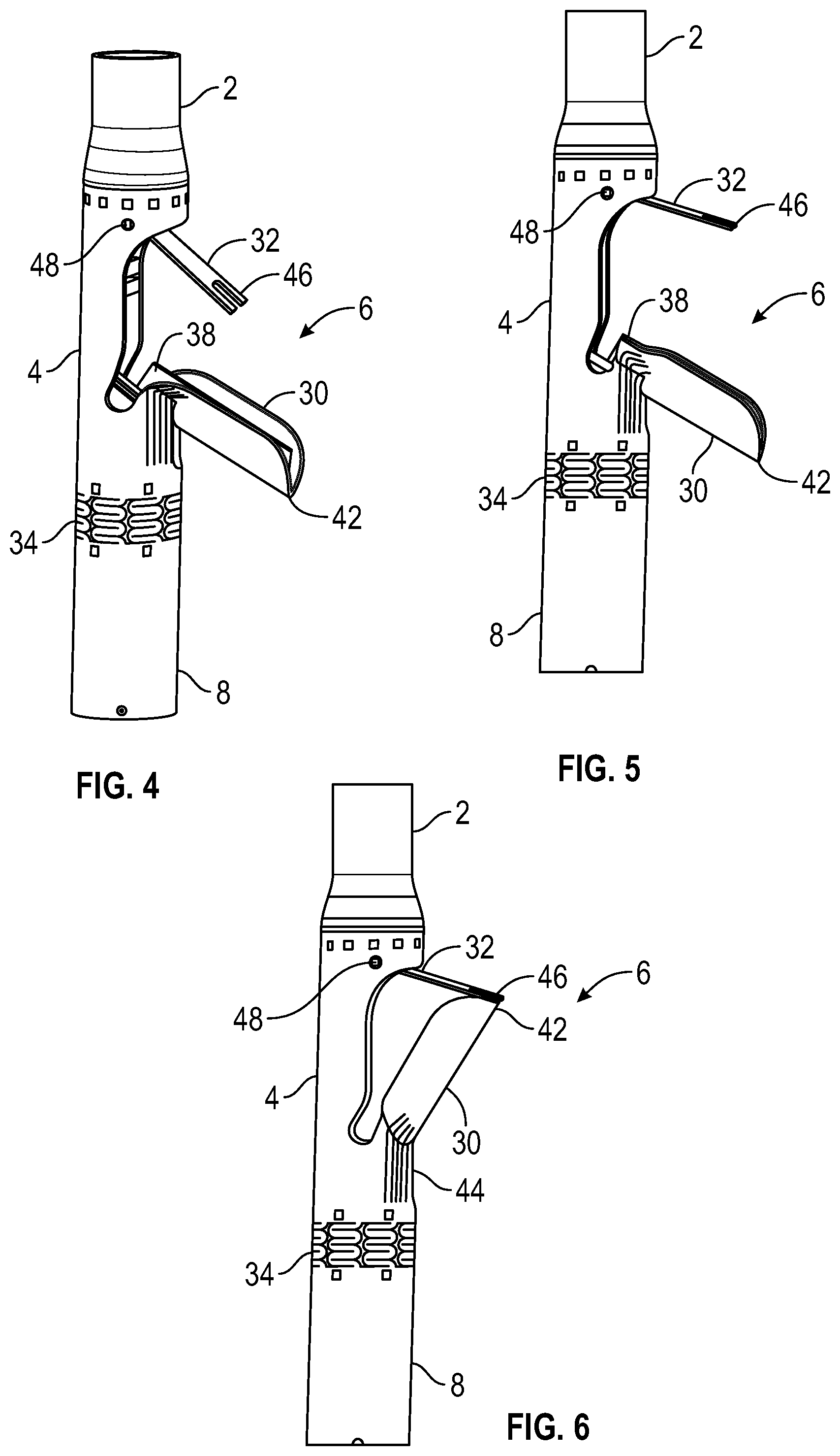 Patent US12350157 Figure 3 – Device for heart repair