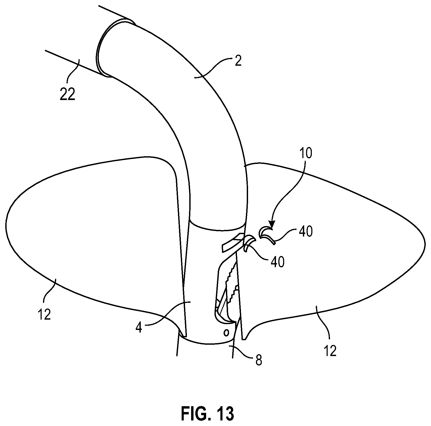 Patent US12350157 Figure 7 – Device for heart repair