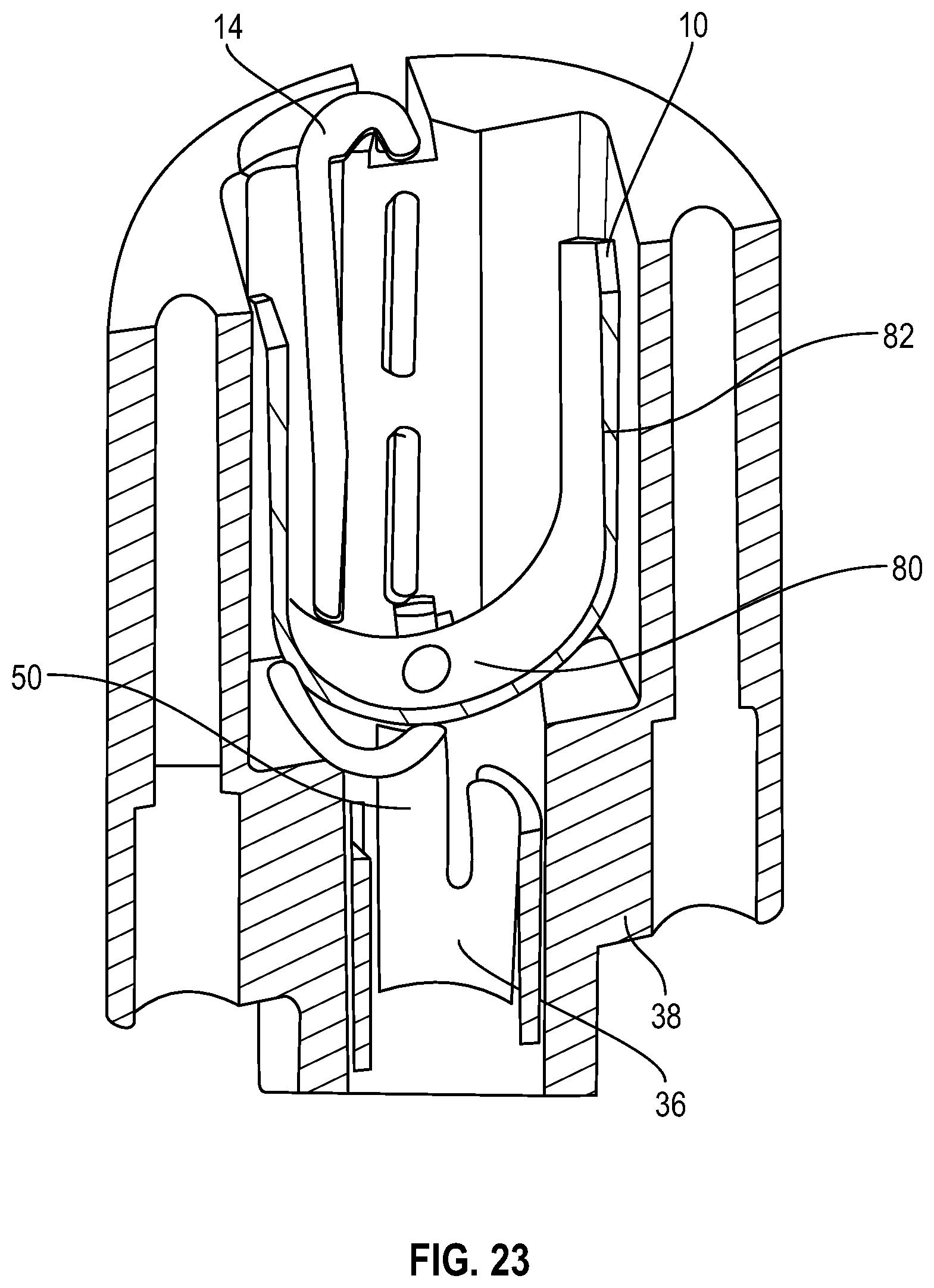 Patent US12350157 Figure 12 – Device for heart repair
