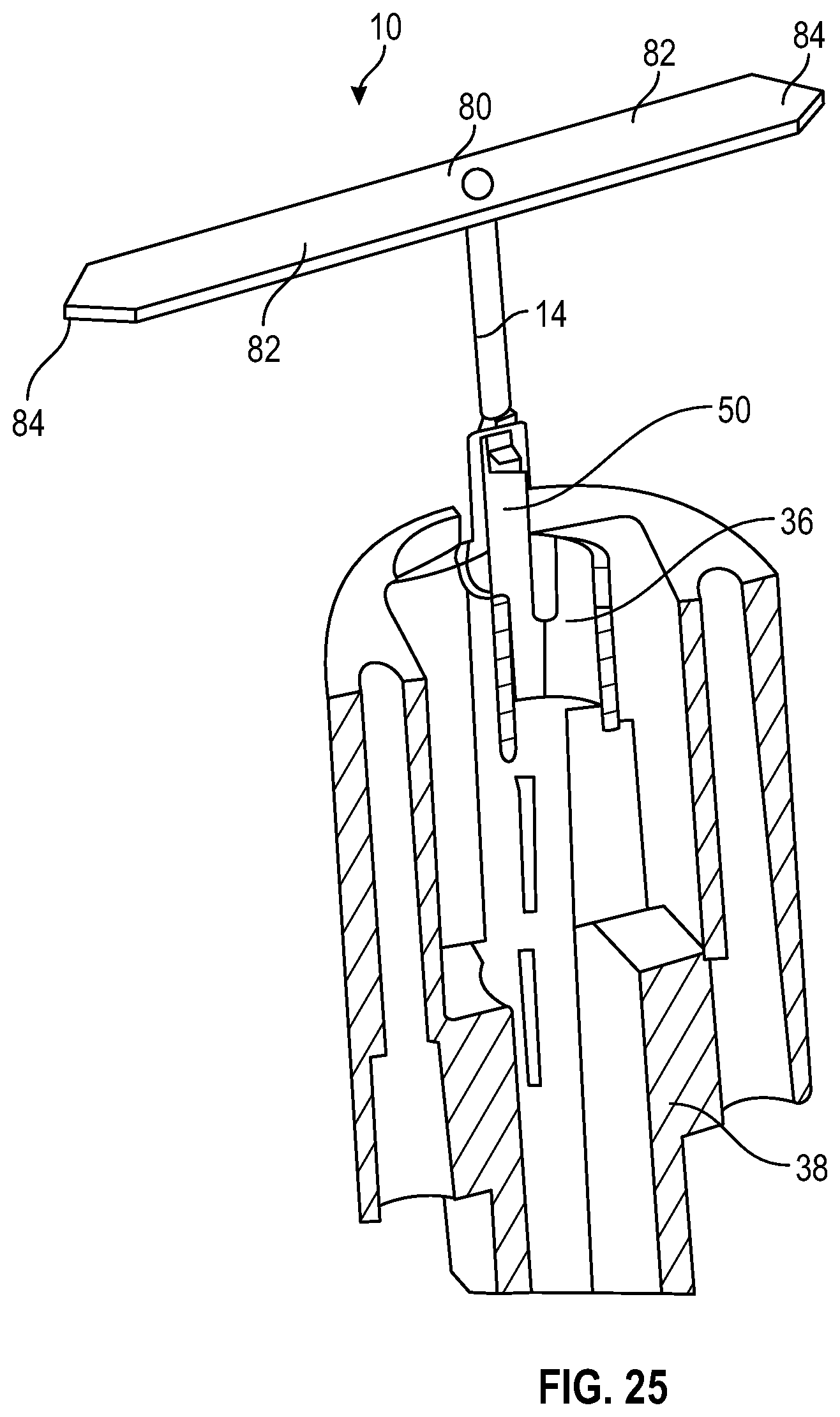 Patent US12350157 Figure 14 – Device for heart repair