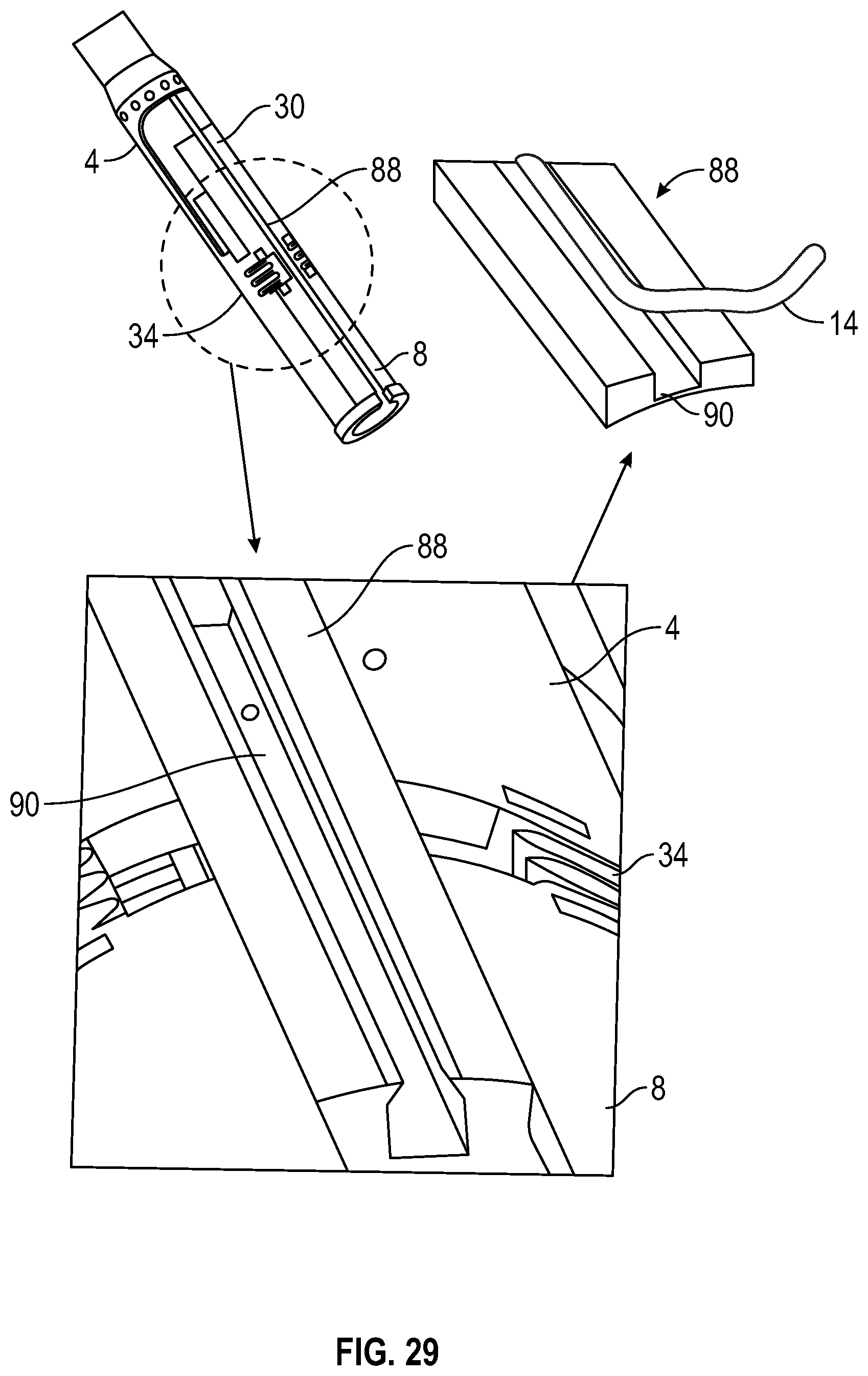 Patent US12350157 Figure 16 – Device for heart repair