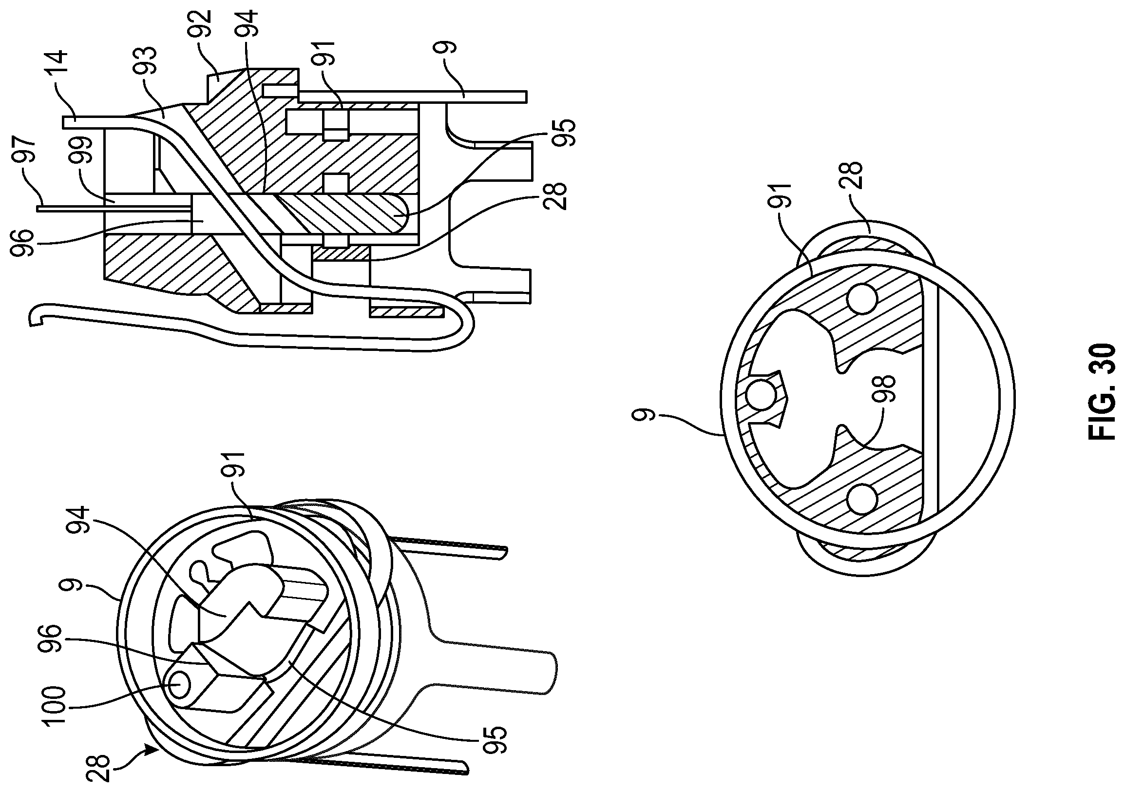 Patent US12350157 Figure 17 – Device for heart repair