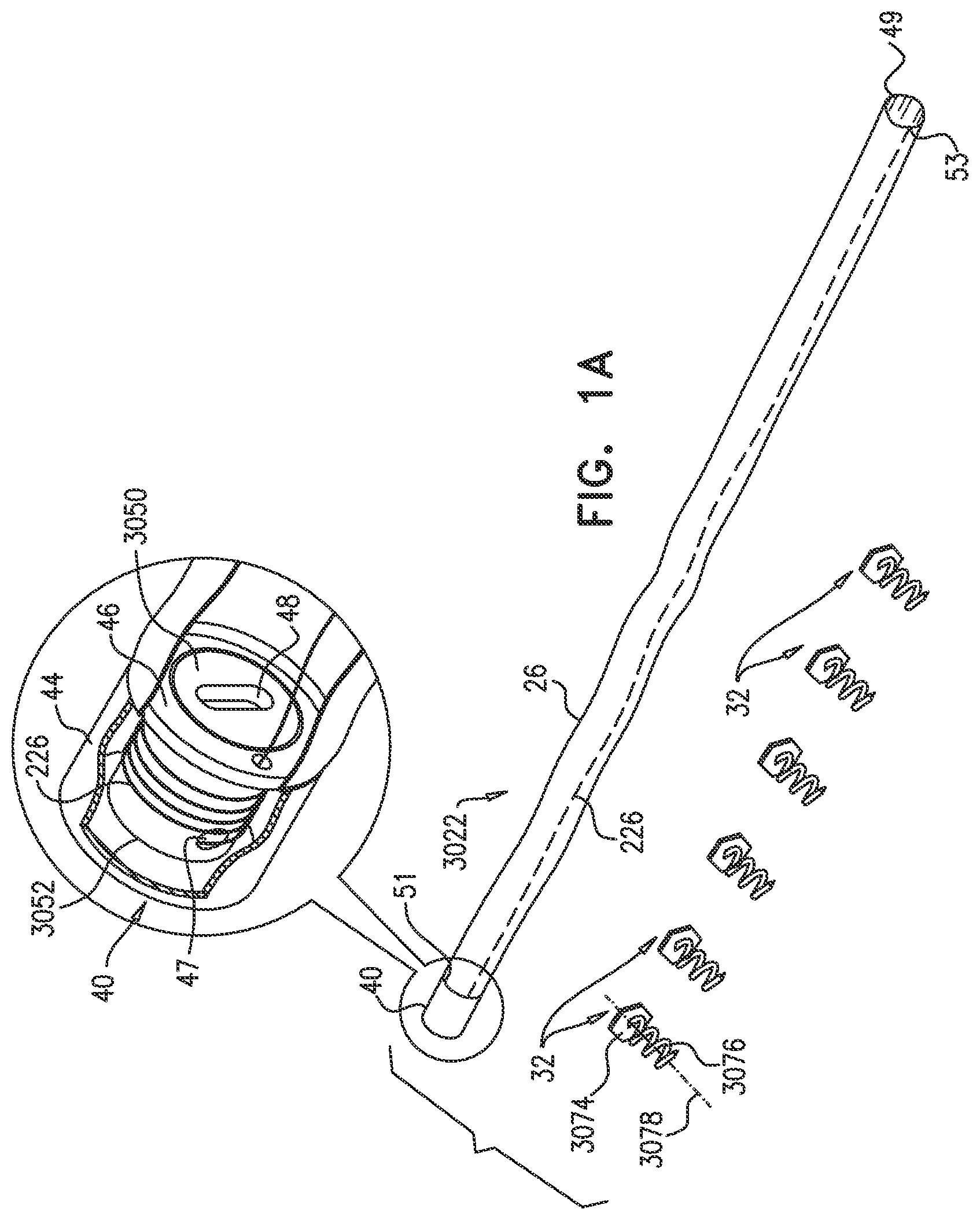Patent US12350158 Figure 1 – Annuloplasty ring delivery catheters