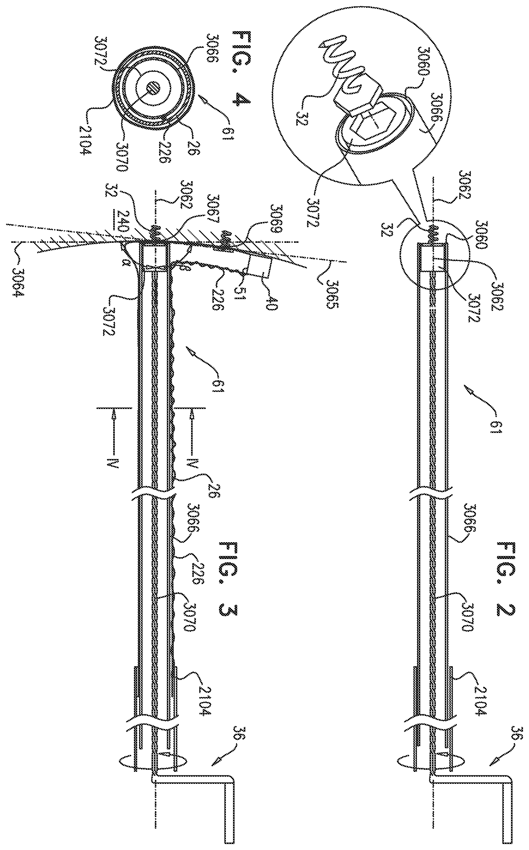 Patent US12350158 Figure 3 – Annuloplasty ring delivery catheters