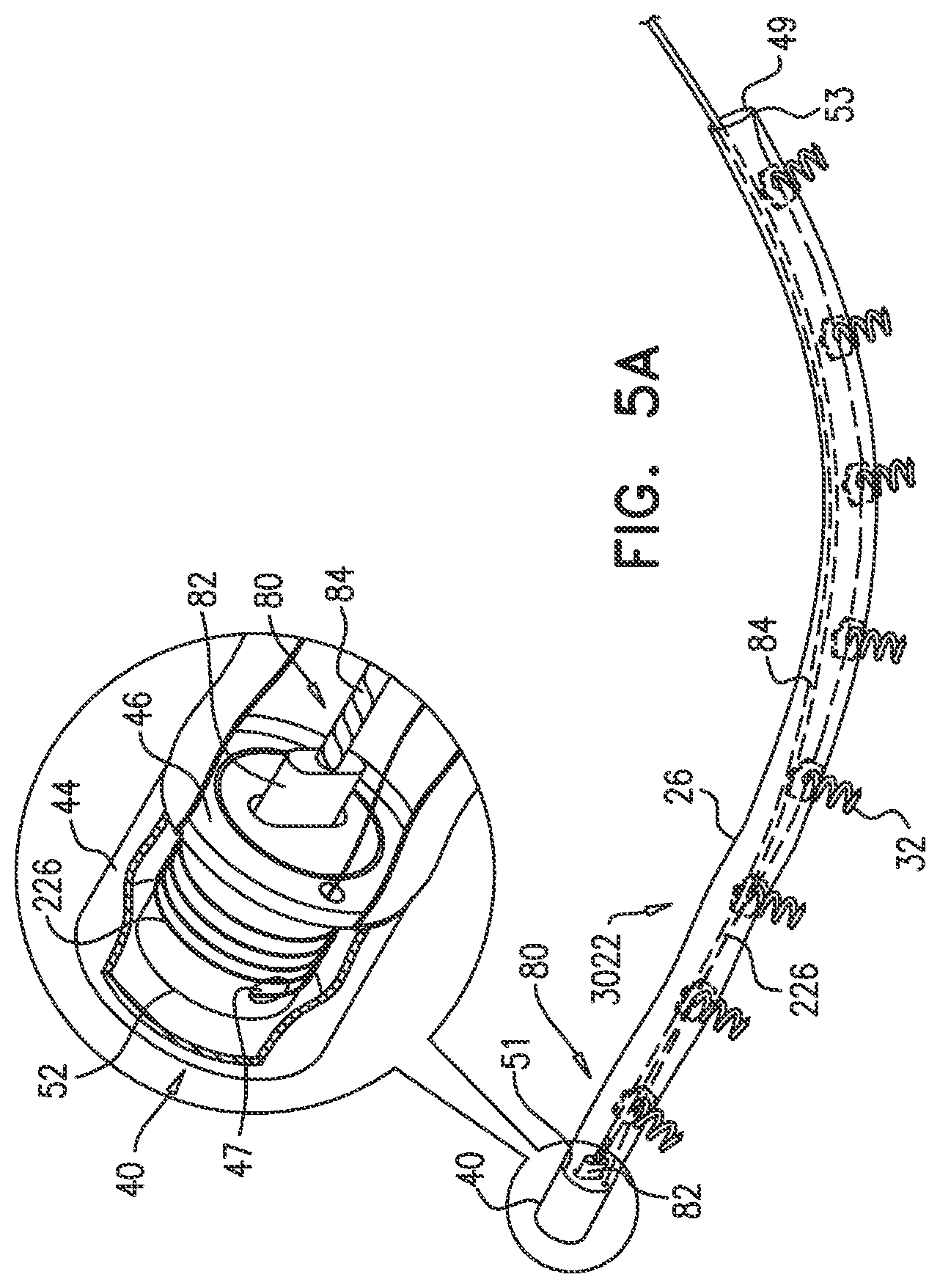 Patent US12350158 Figure 4 – Annuloplasty ring delivery catheters