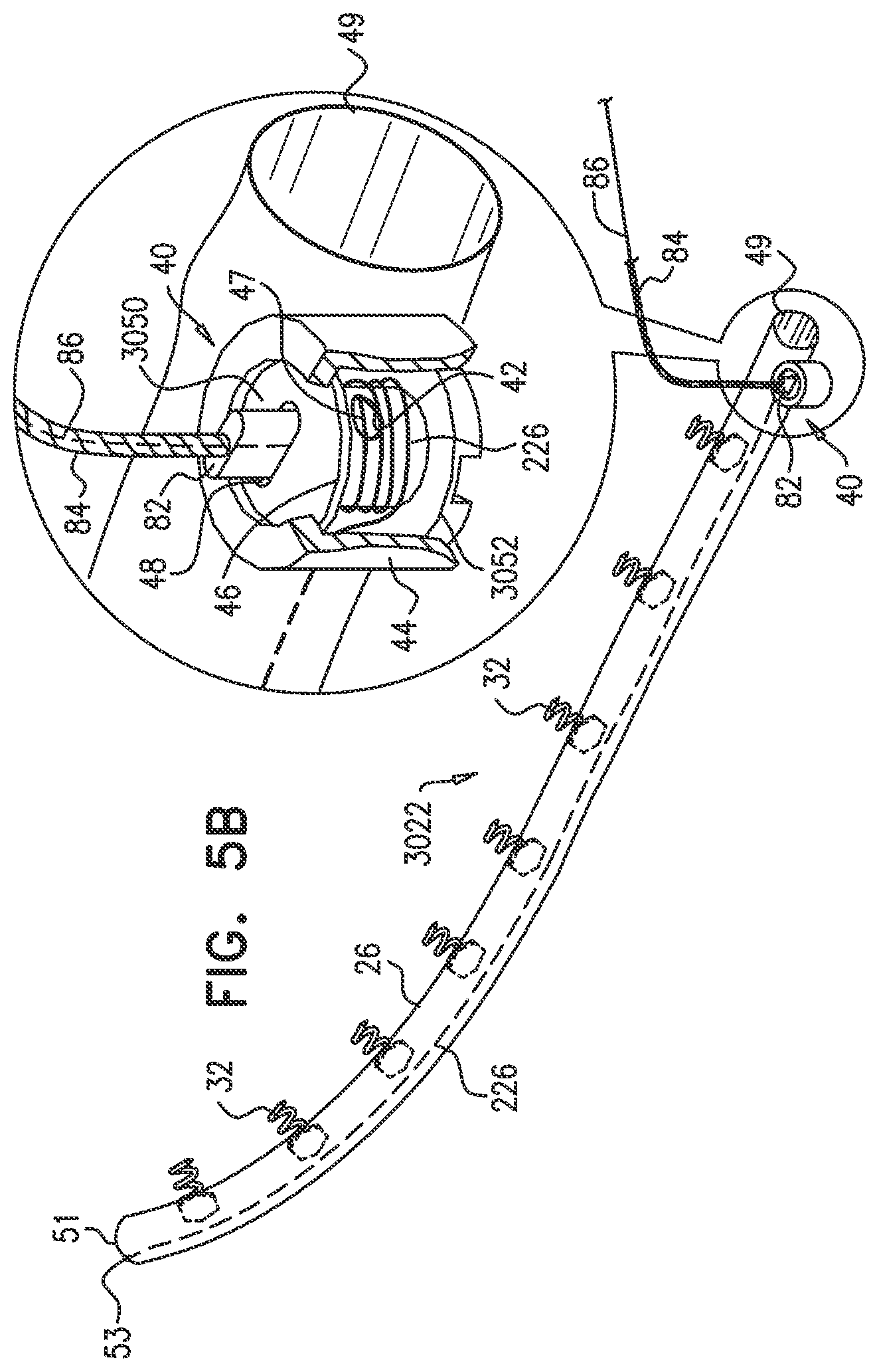 Patent US12350158 Figure 5 – Annuloplasty ring delivery catheters