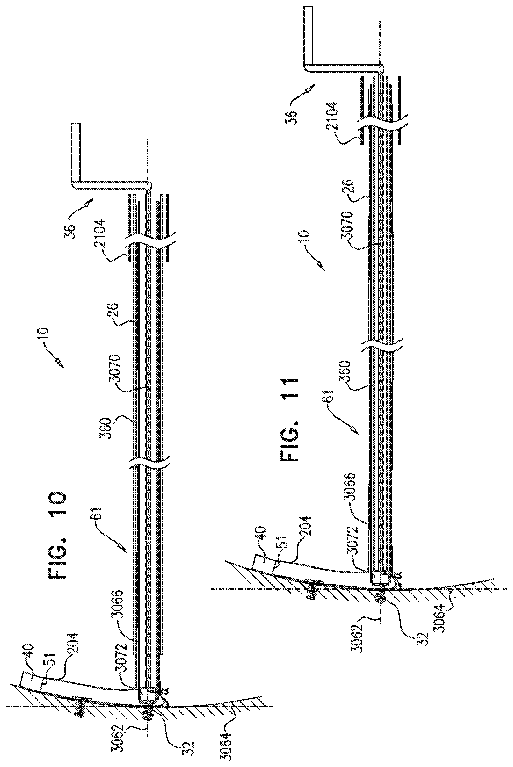 Patent US12350158 Figure 14 – Annuloplasty ring delivery catheters