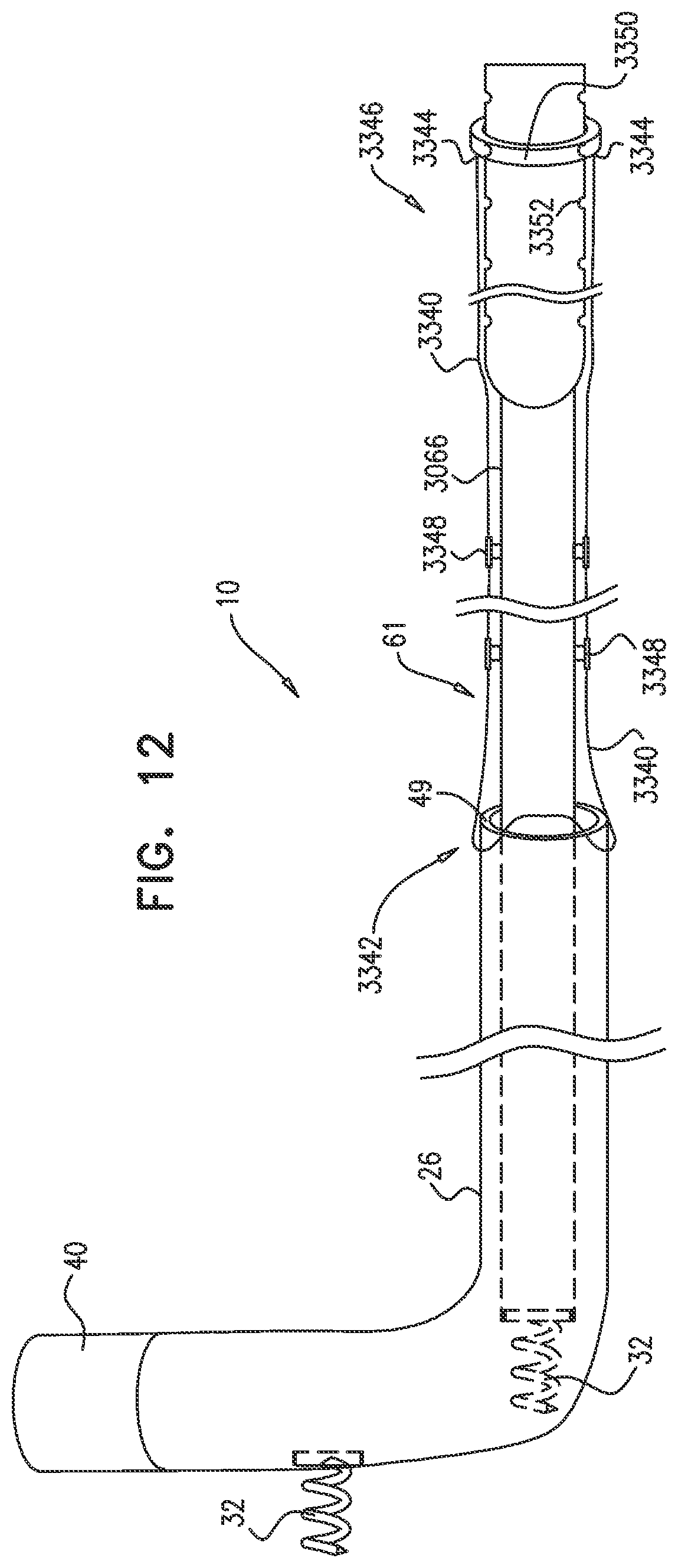 Patent US12350158 Figure 15 – Annuloplasty ring delivery catheters