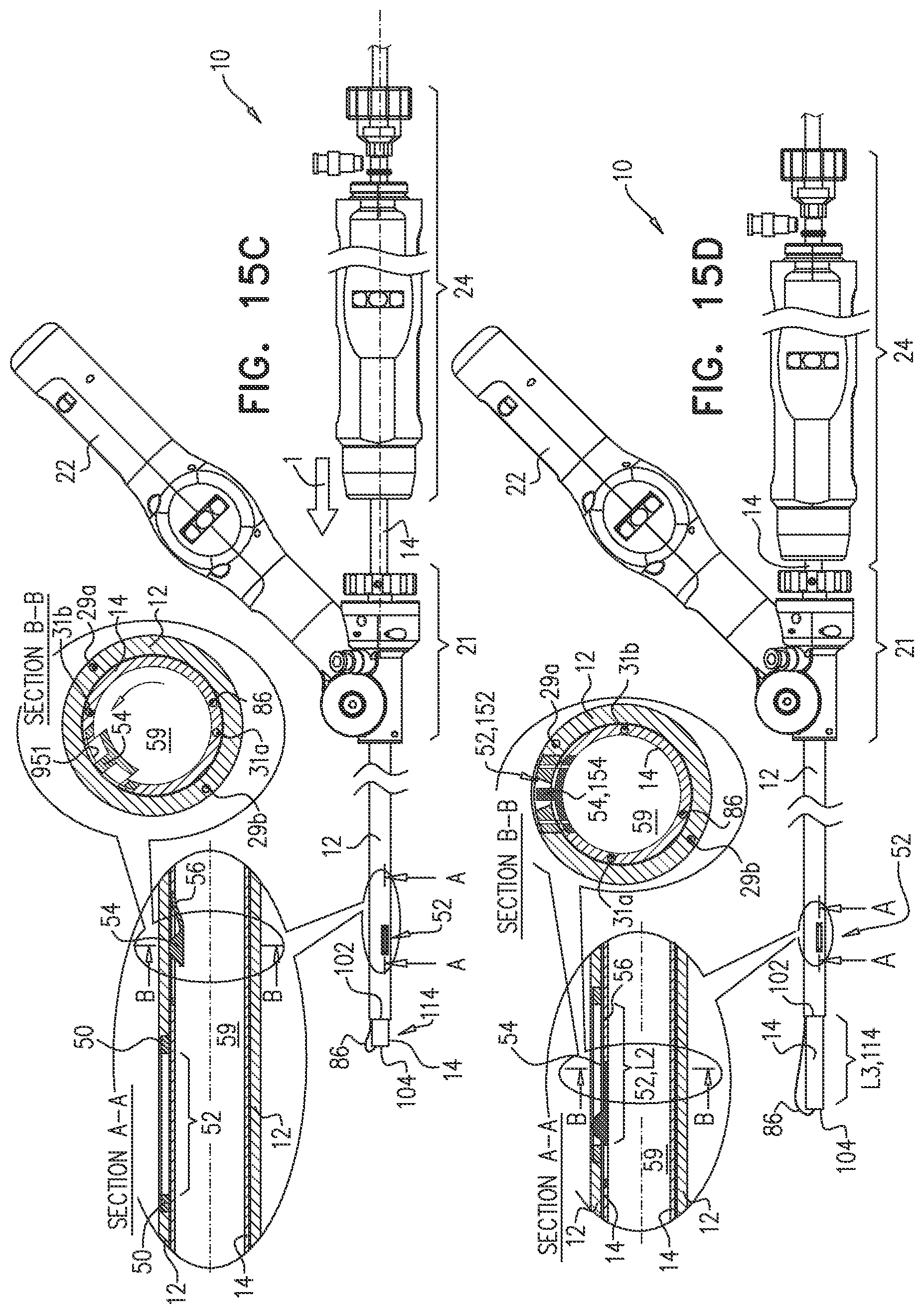 Patent US12350158 Figure 19 – Annuloplasty ring delivery catheters