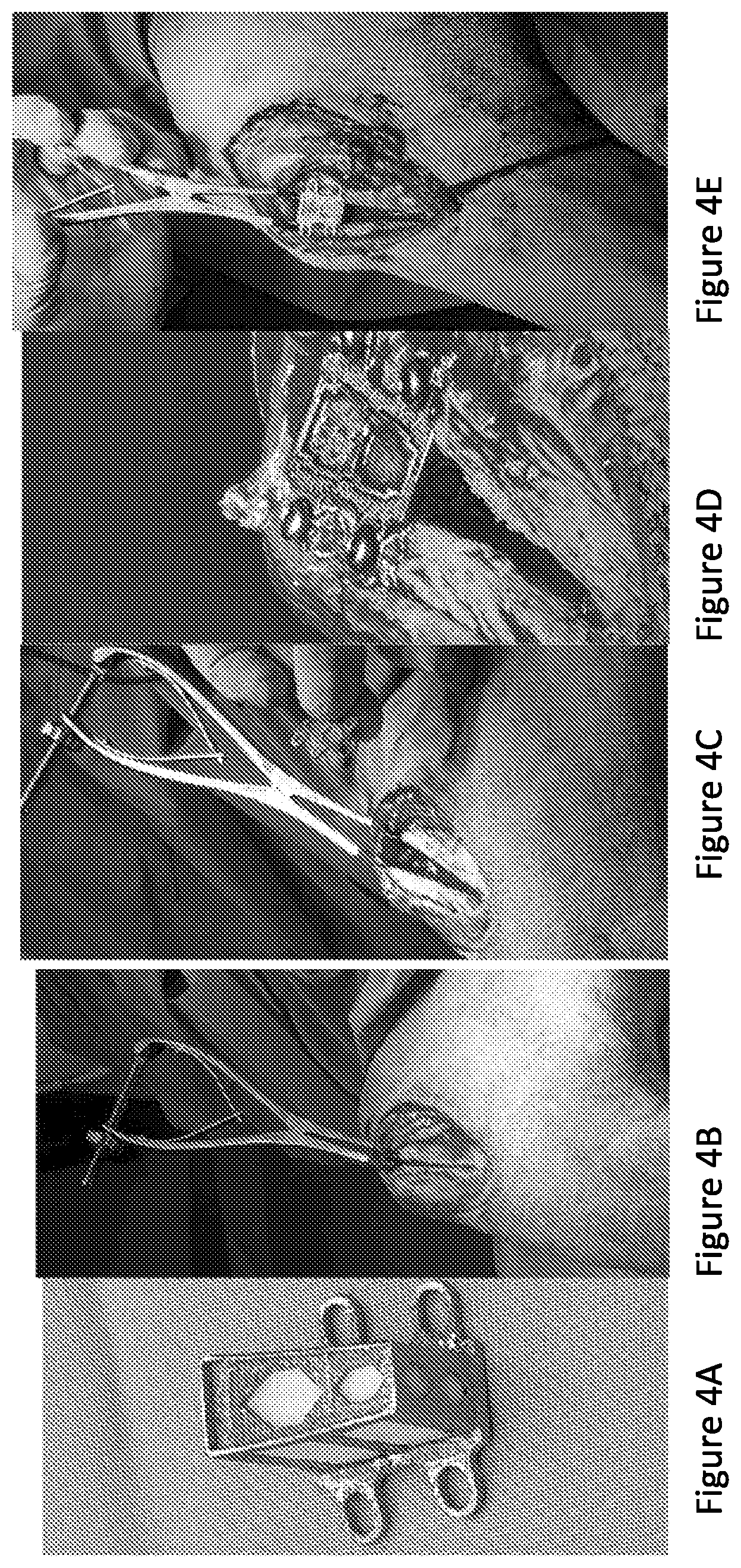Patent US12350159 Figure 5 – Optimized cage systems promoting bone repair and fusion