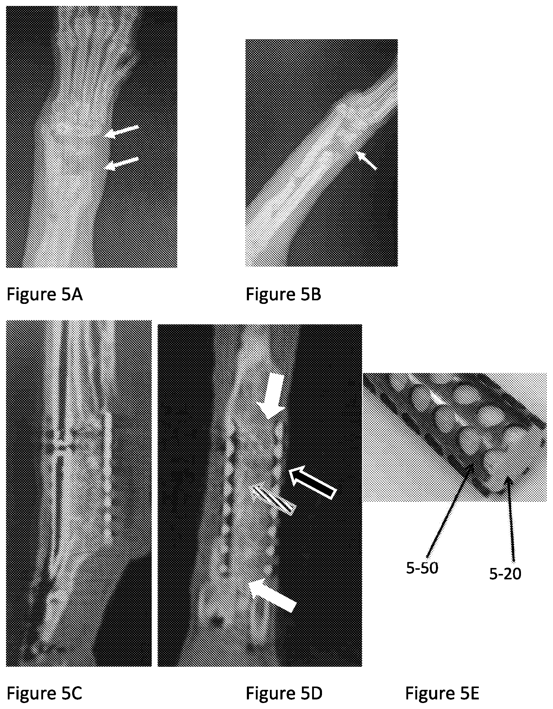 Patent US12350159 Figure 6 – Optimized cage systems promoting bone repair and fusion