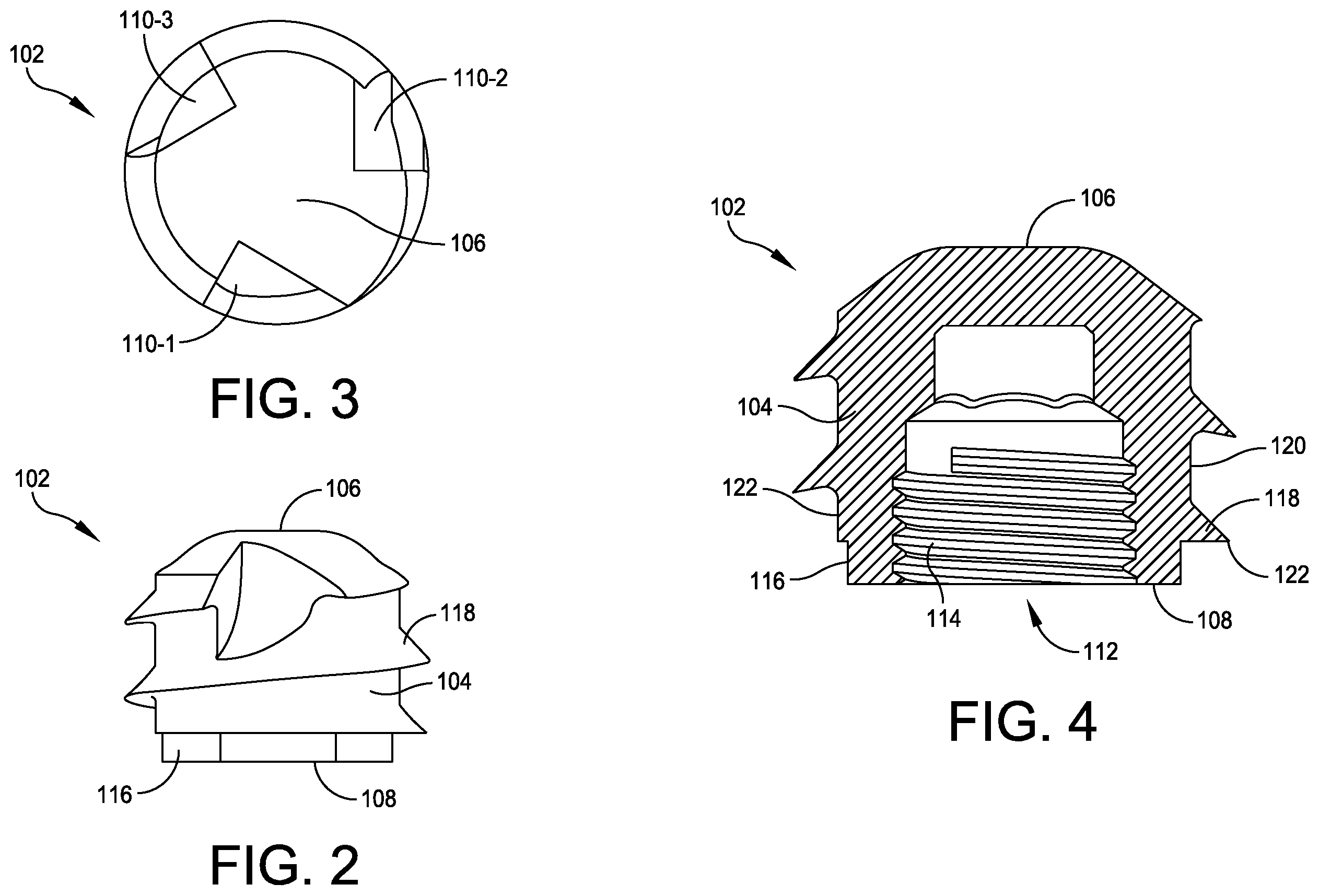 Patent US12350160 Figure 2 – Modular implant with external fixation