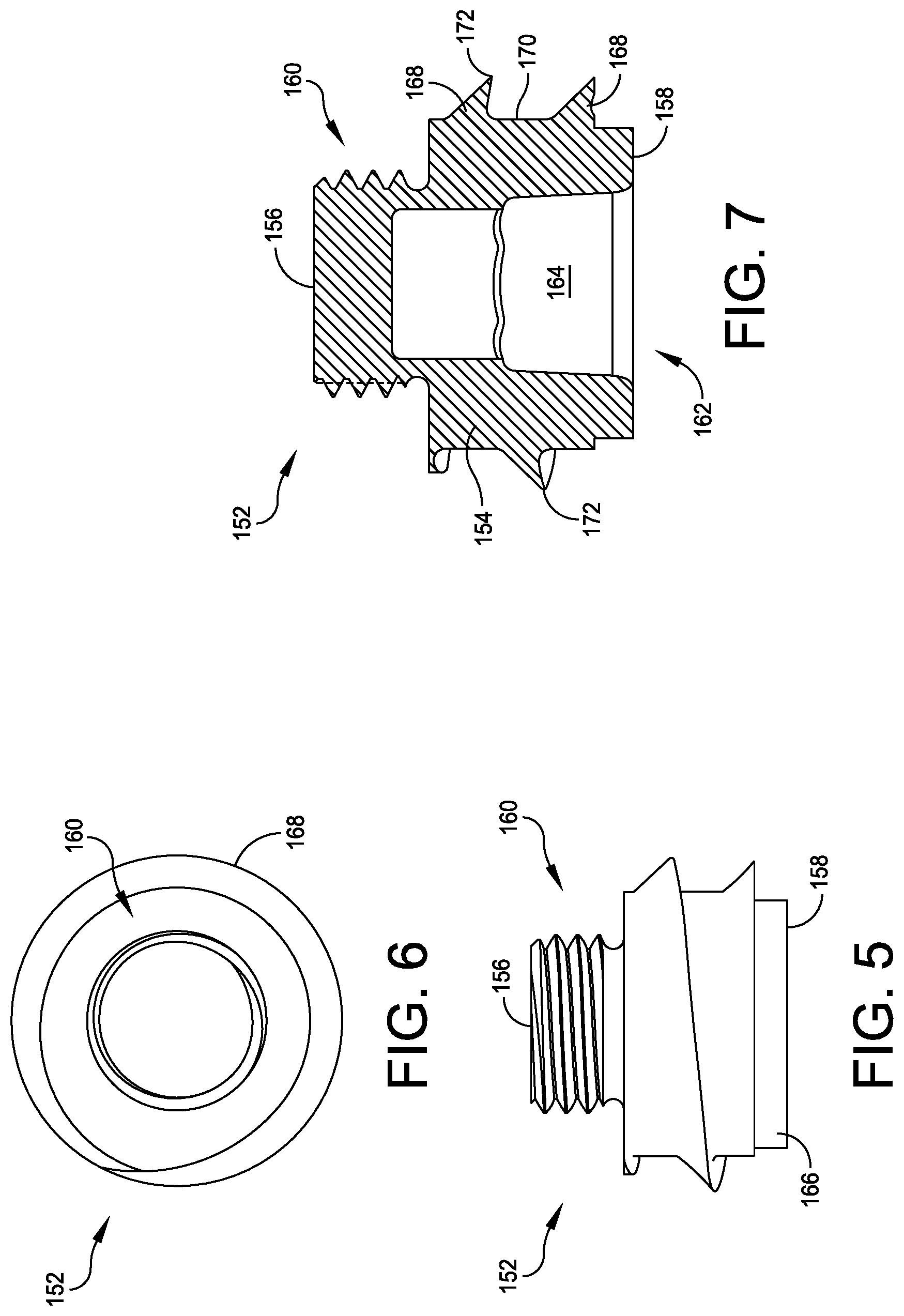 Patent US12350160 Figure 3 – Modular implant with external fixation