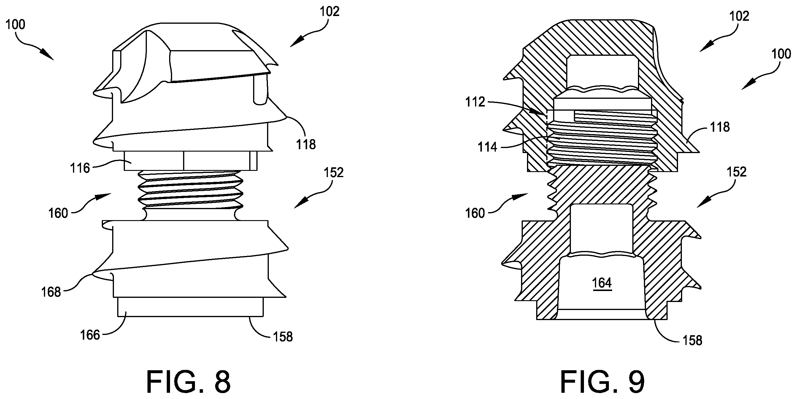 Patent US12350160 Figure 4 – Modular implant with external fixation
