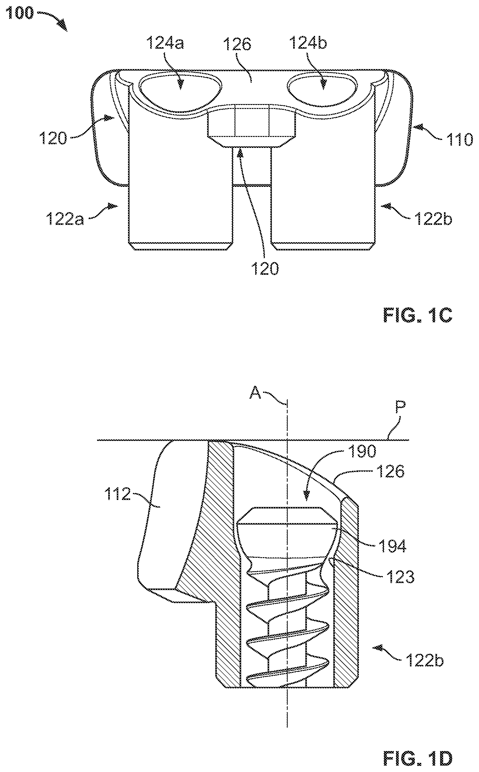 Patent US12350161 Figure 2 – Joint replacement augments and associated instrumentation