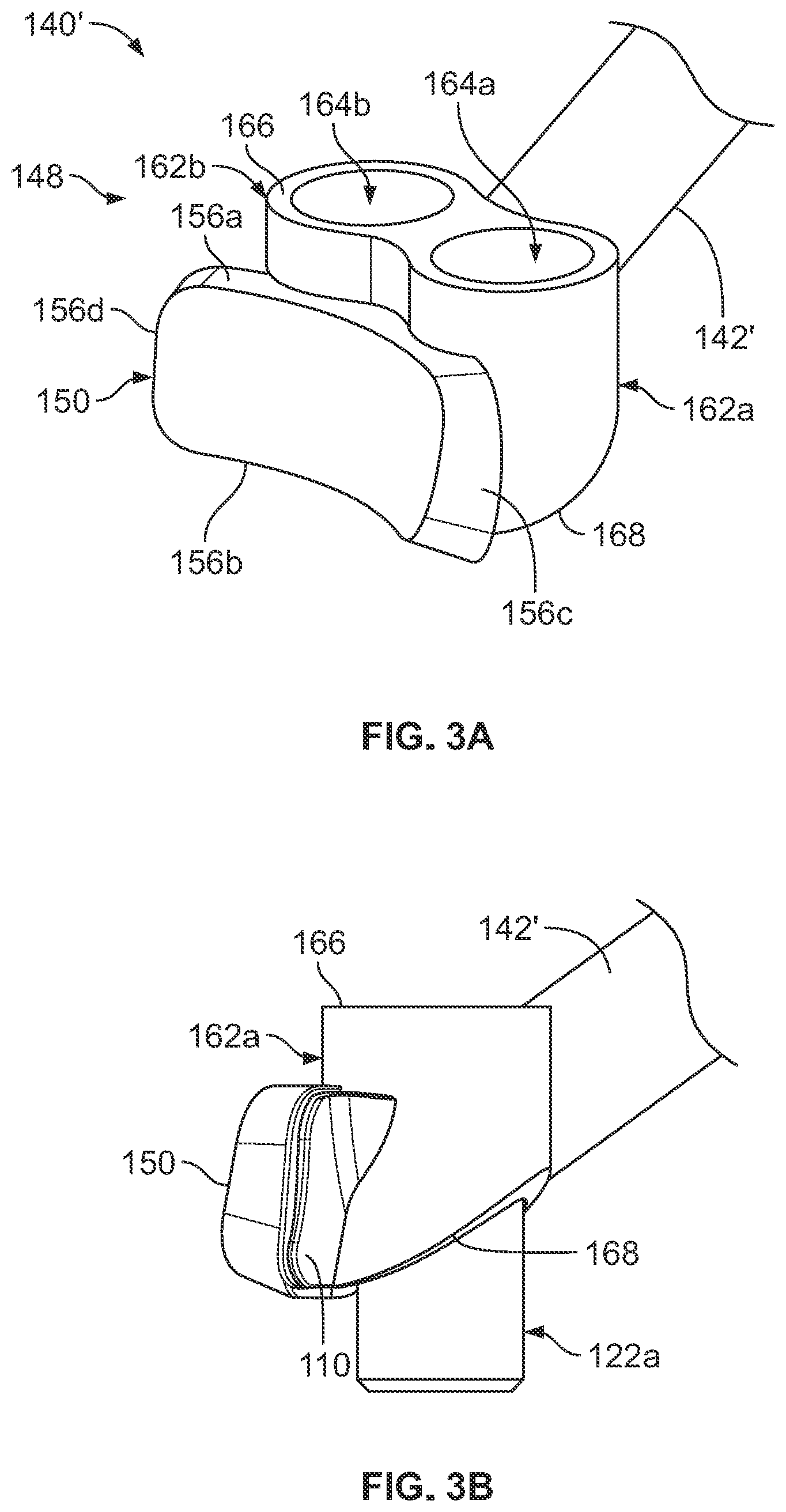 Patent US12350161 Figure 4 – Joint replacement augments and associated instrumentation