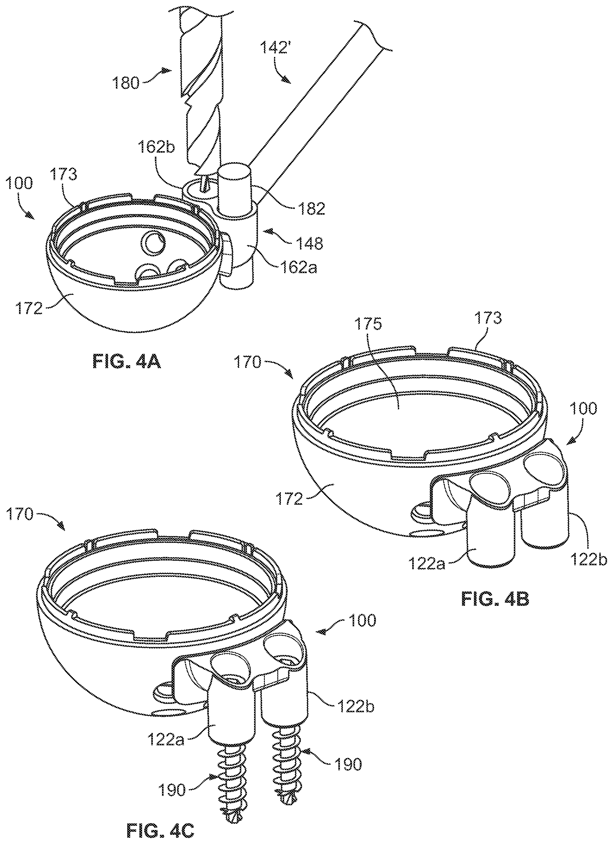 Patent US12350161 Figure 5 – Joint replacement augments and associated instrumentation