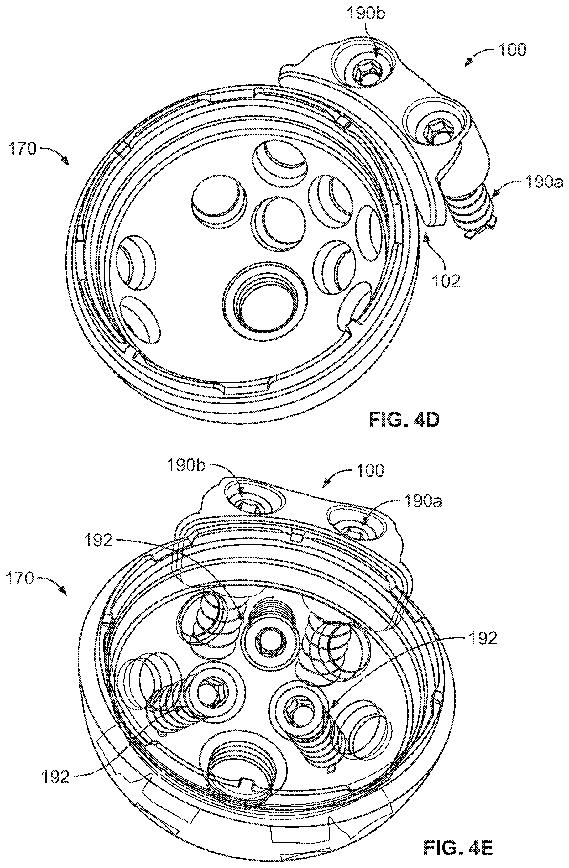 Patent US12350161 Figure 6 – Joint replacement augments and associated instrumentation