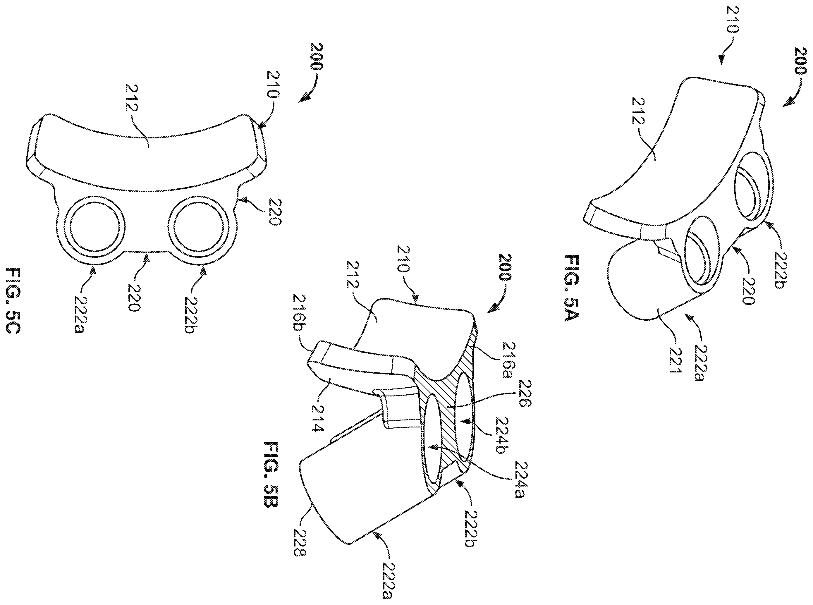 Patent US12350161 Figure 7 – Joint replacement augments and associated instrumentation