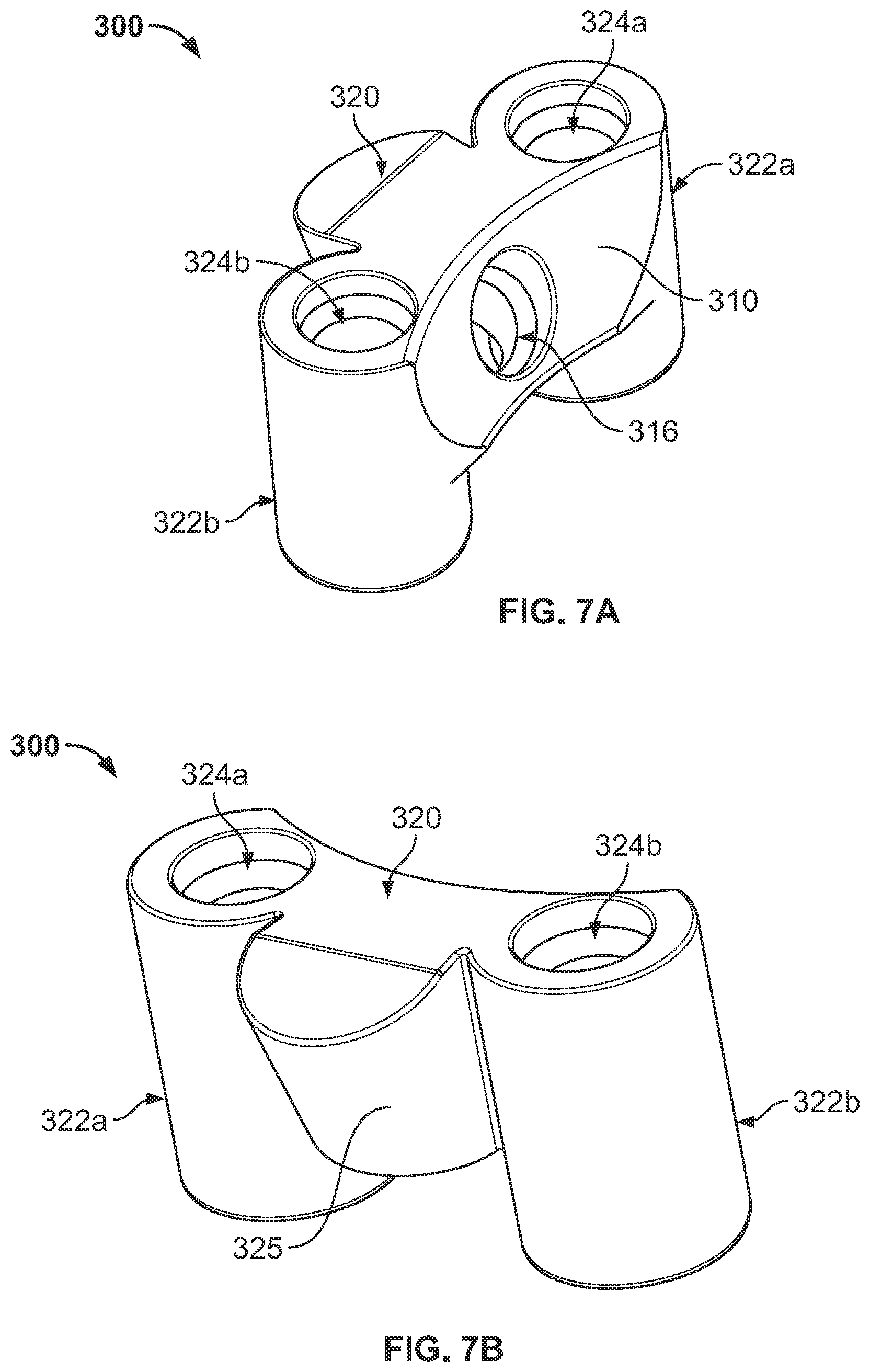 Patent US12350161 Figure 9 – Joint replacement augments and associated instrumentation