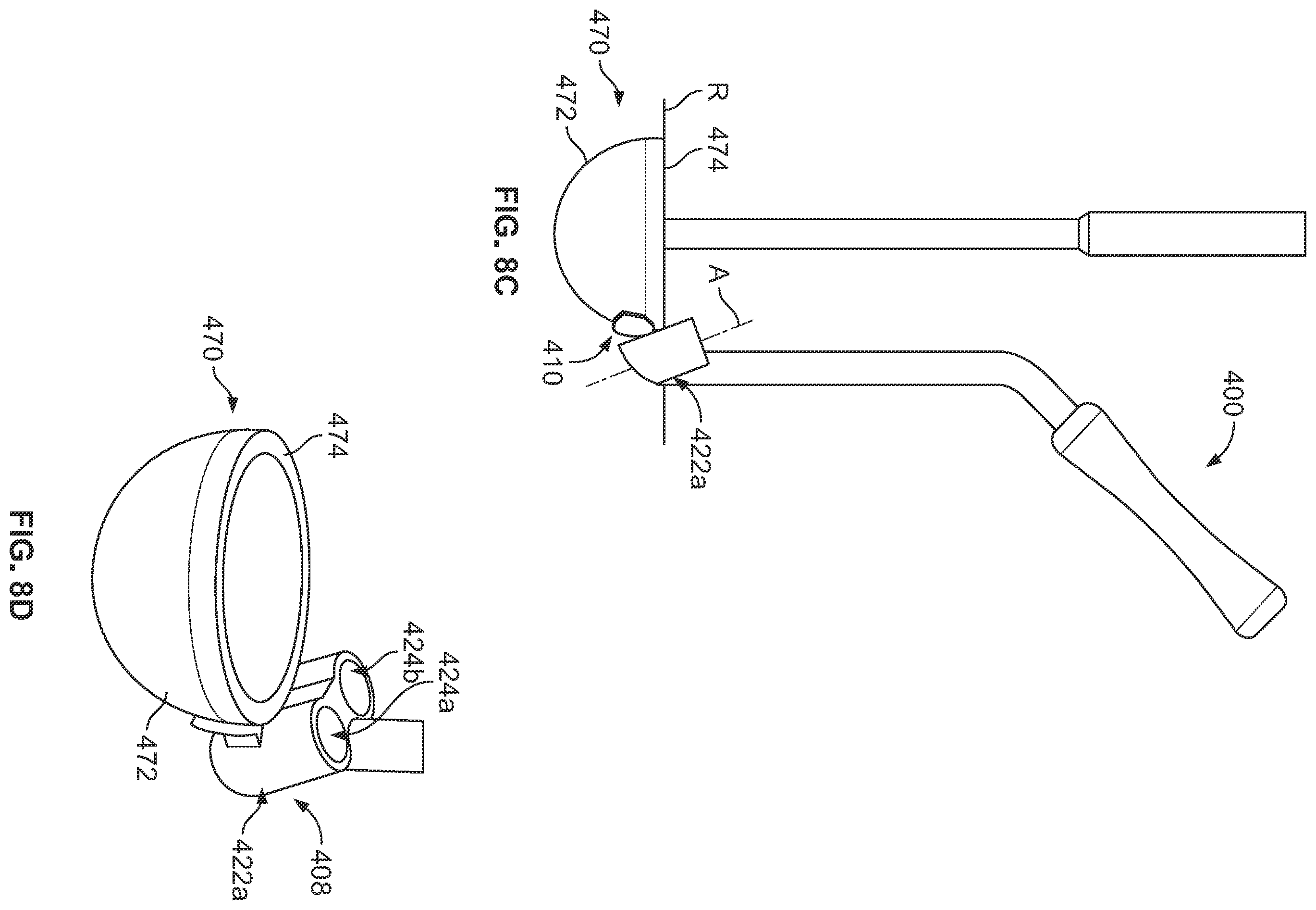 Patent US12350161 Figure 11 – Joint replacement augments and associated instrumentation