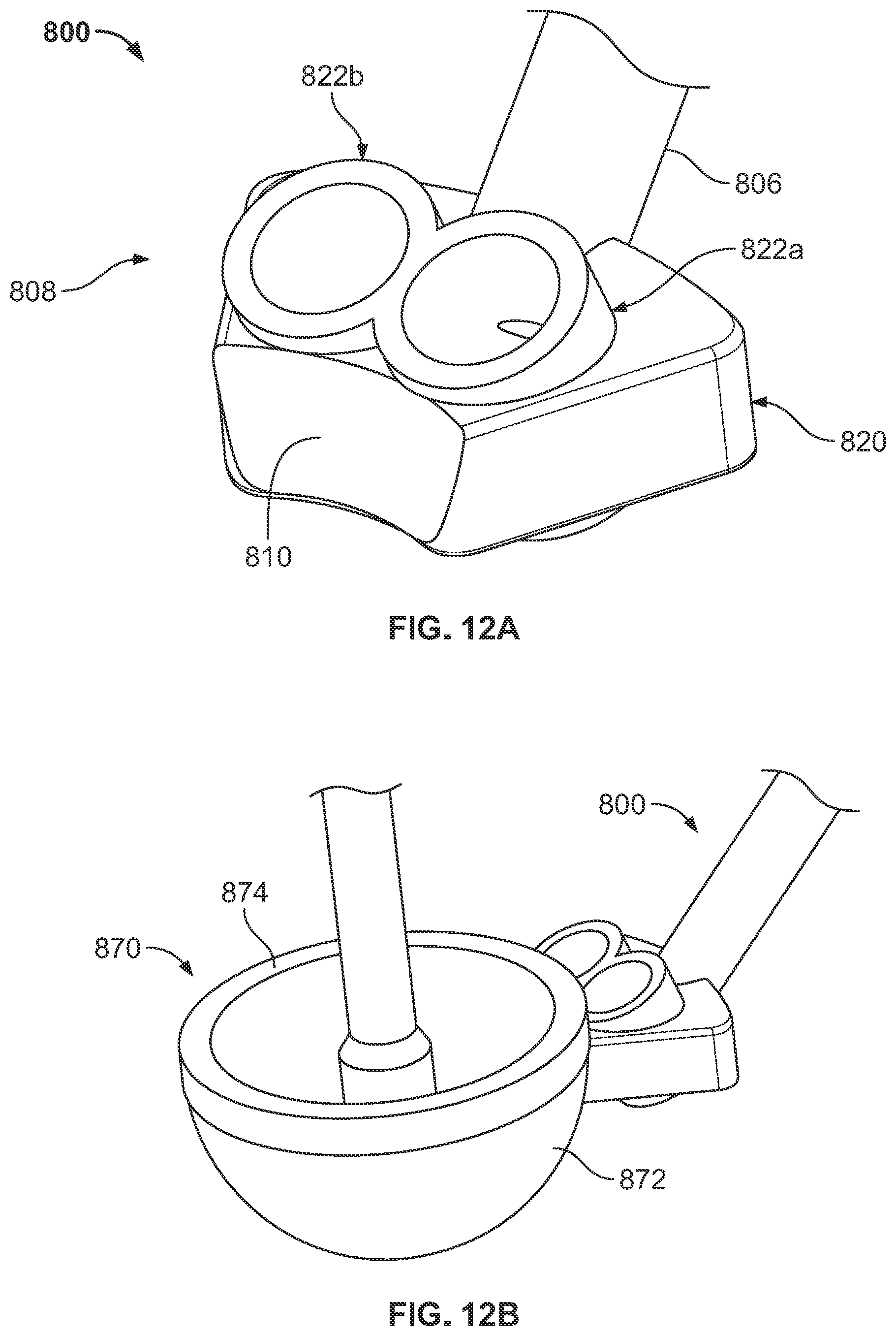 Patent US12350161 Figure 14 – Joint replacement augments and associated instrumentation