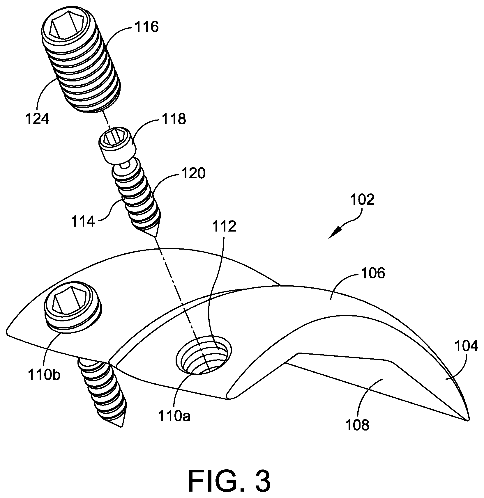 Patent US12350163 Figure 2 – Modular talar fixation method and system