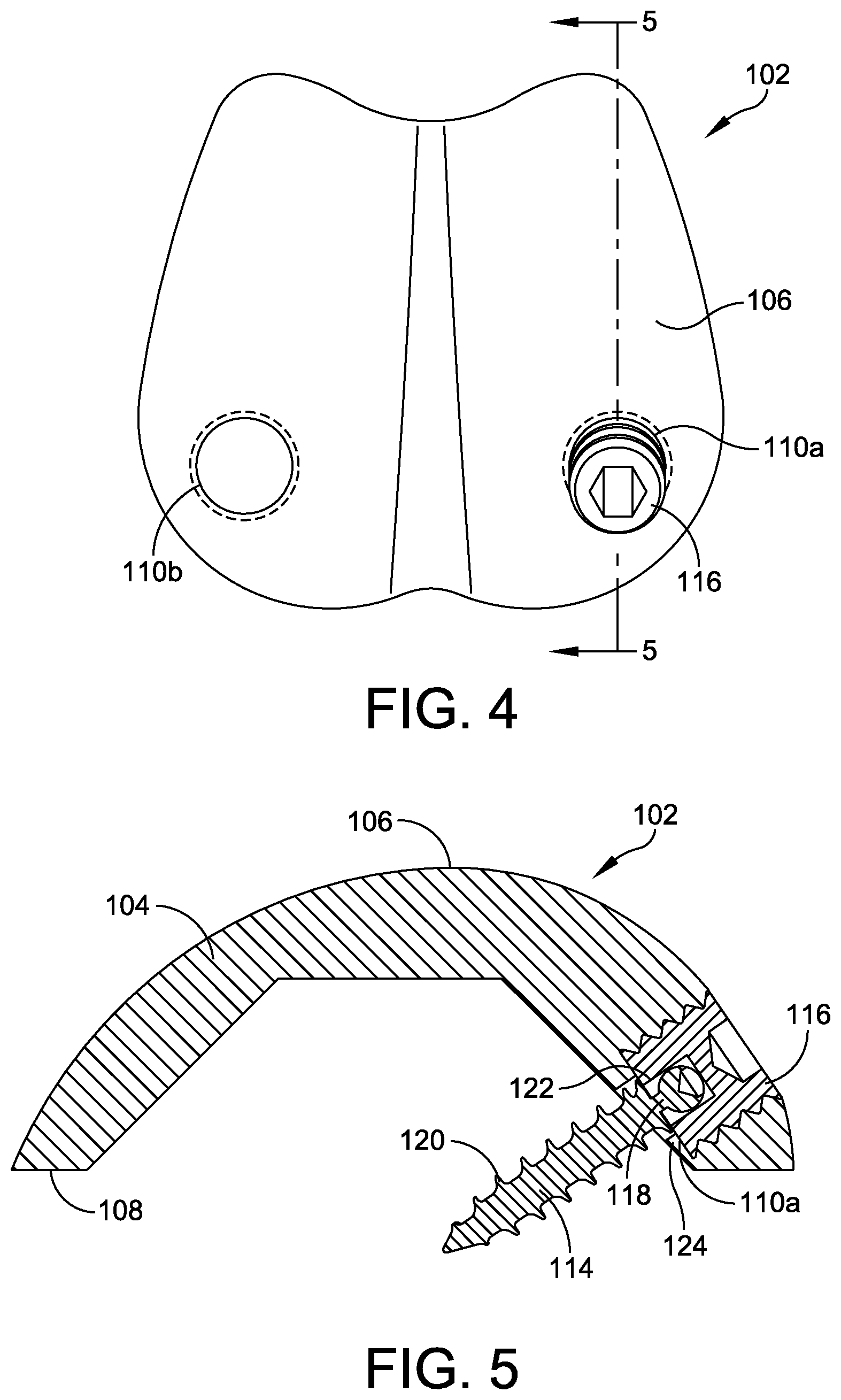 Patent US12350163 Figure 3 – Modular talar fixation method and system