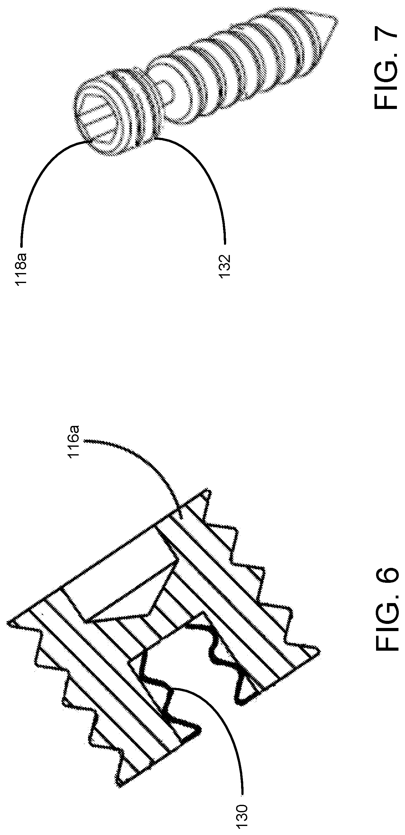 Patent US12350163 Figure 4 – Modular talar fixation method and system