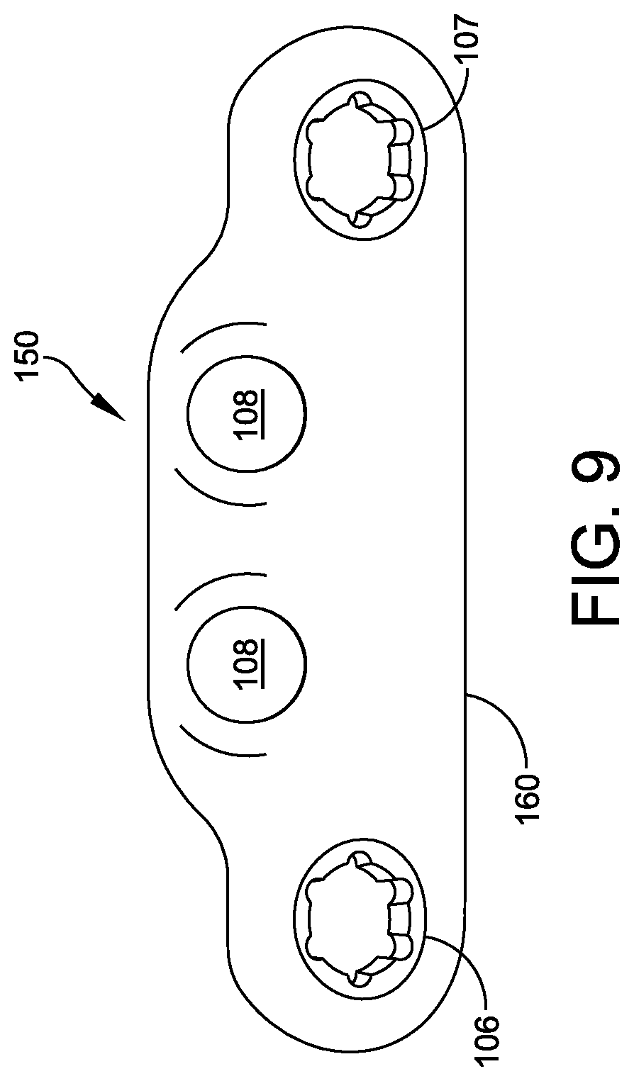 Patent US12350164 Figure 2 – Implant and method for ankle syndemosis treatment