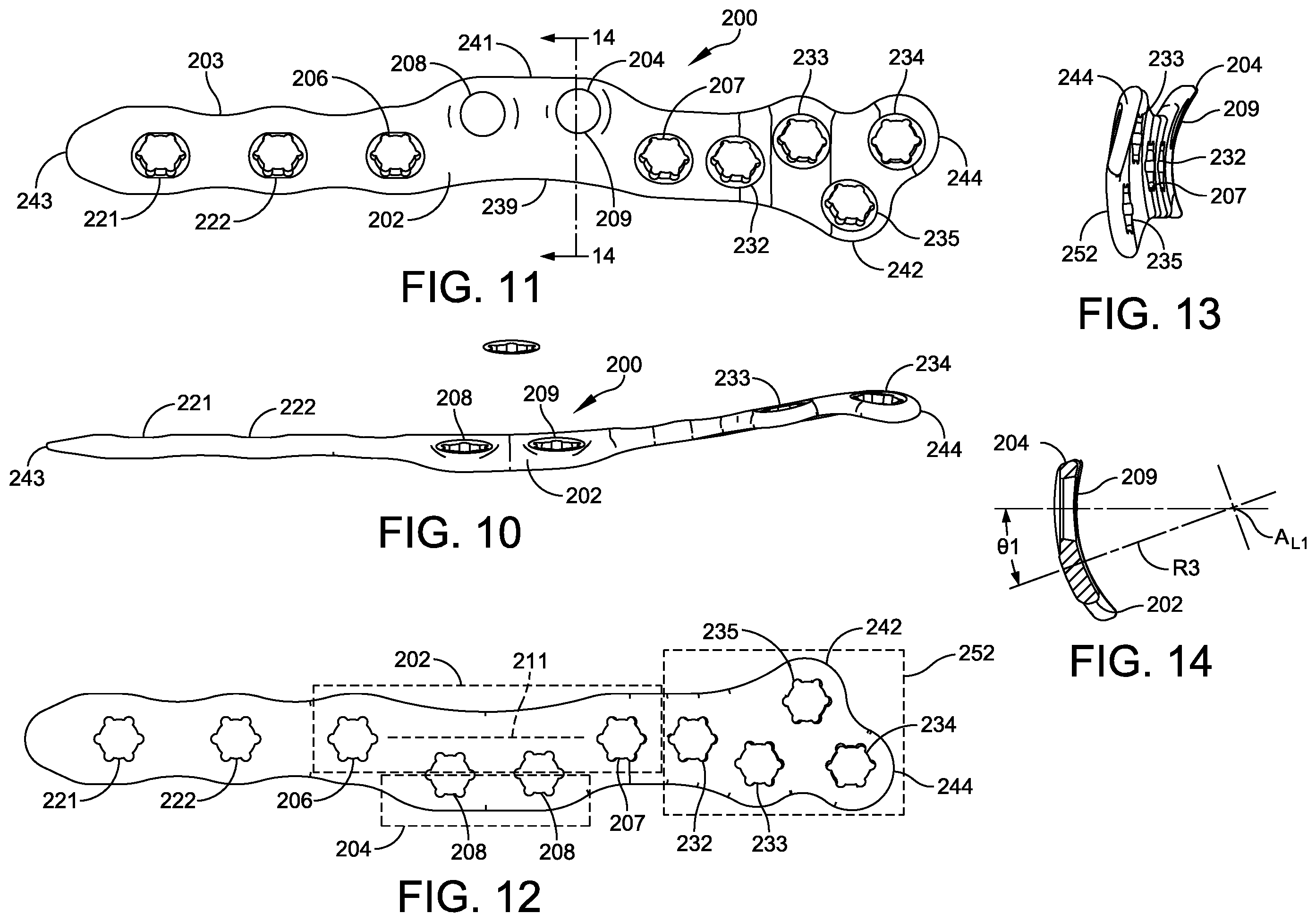 Patent US12350164 Figure 3 – Implant and method for ankle syndemosis treatment