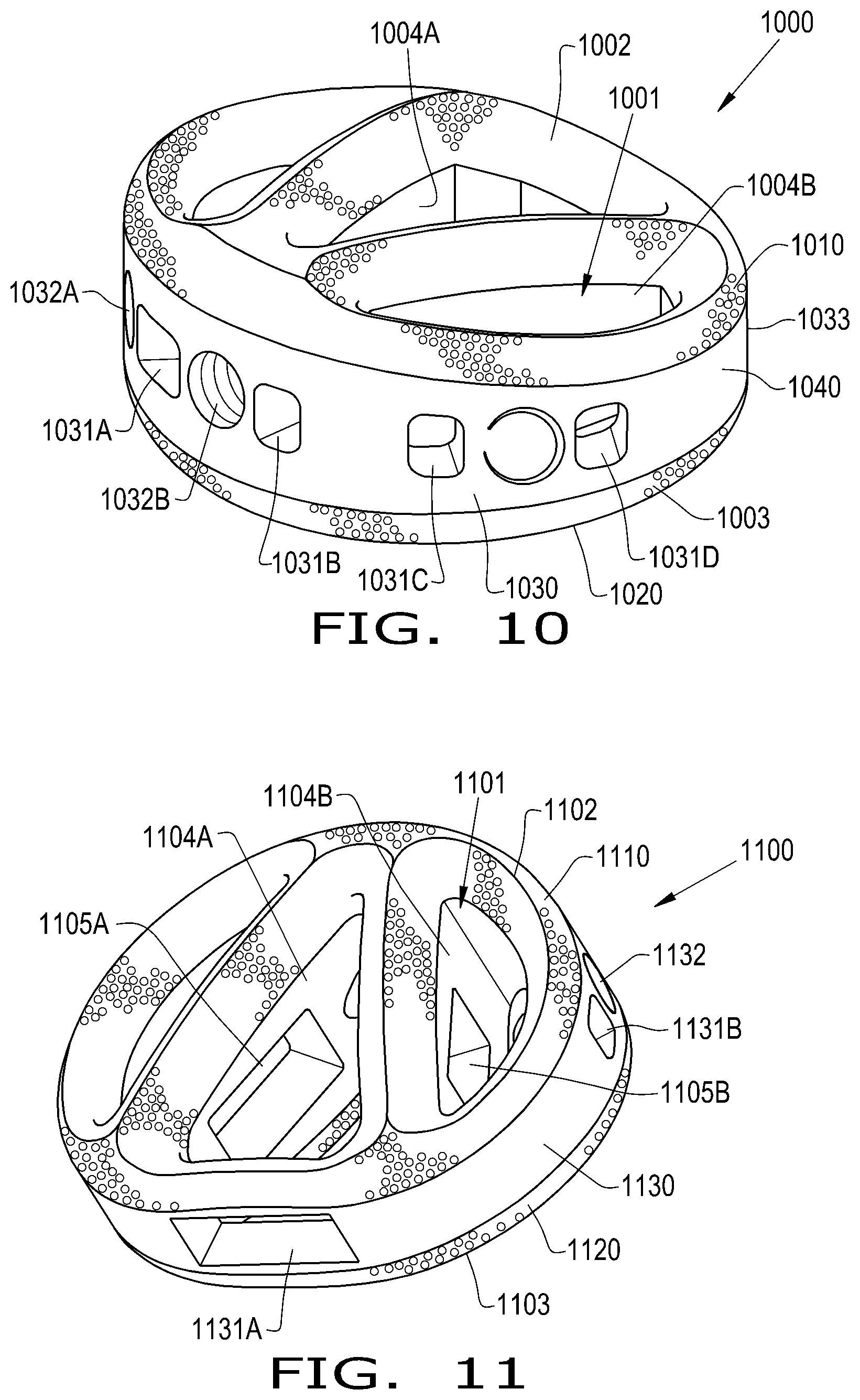 Patent US12350165 Figure 6 – Adjusted stiffness orthopaedic implants and method of manufacture