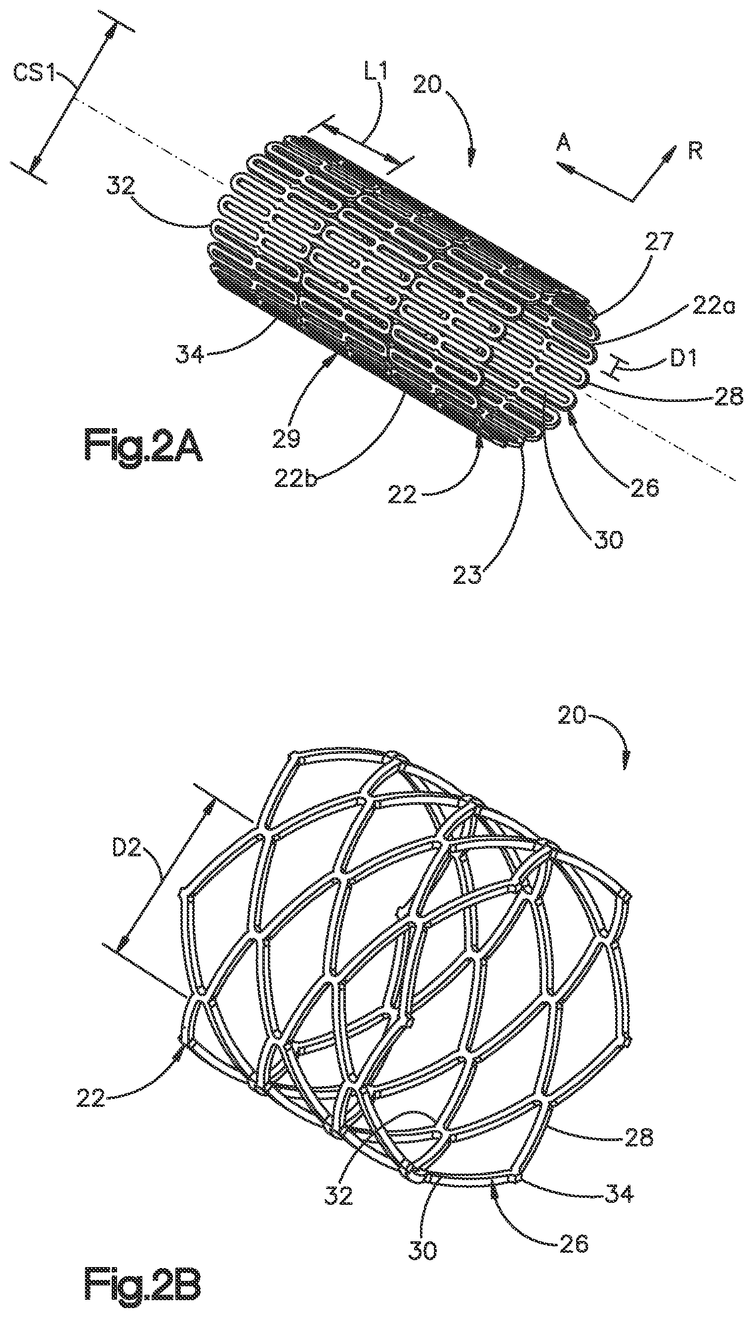 Patent US12350166 Figure 3 – Method and apparatus for augmenting bone