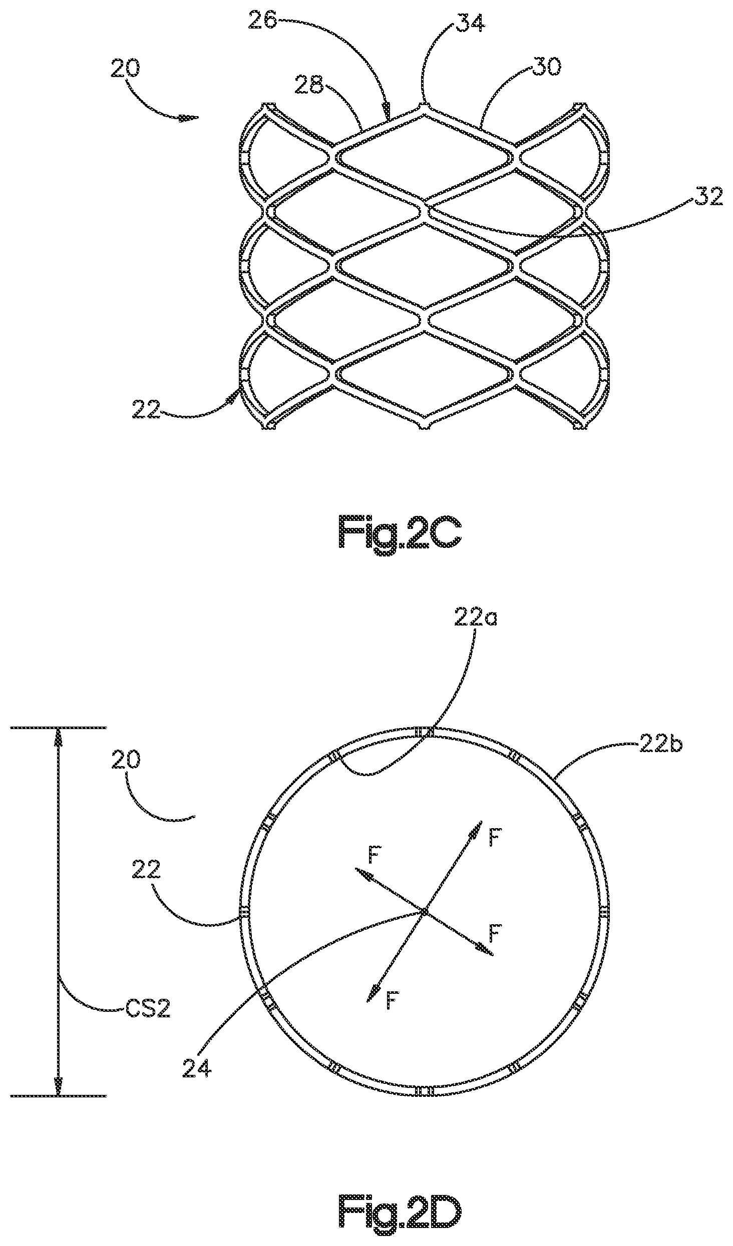Patent US12350166 Figure 4 – Method and apparatus for augmenting bone