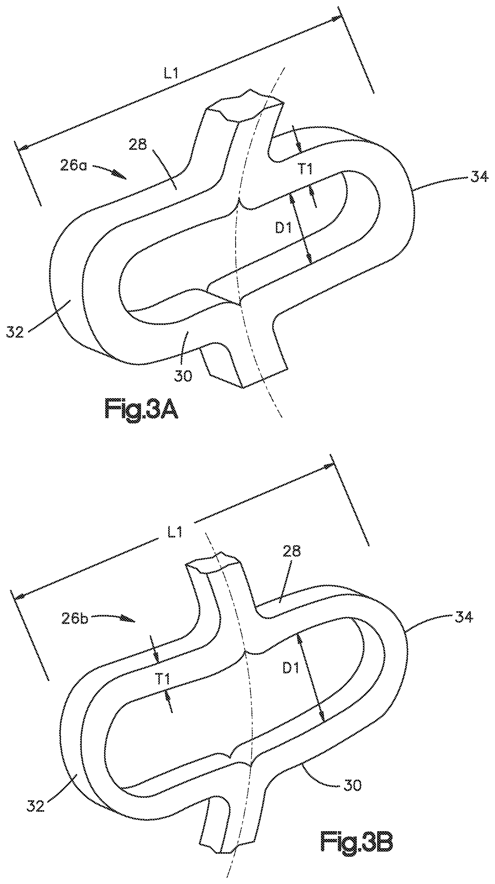 Patent US12350166 Figure 5 – Method and apparatus for augmenting bone