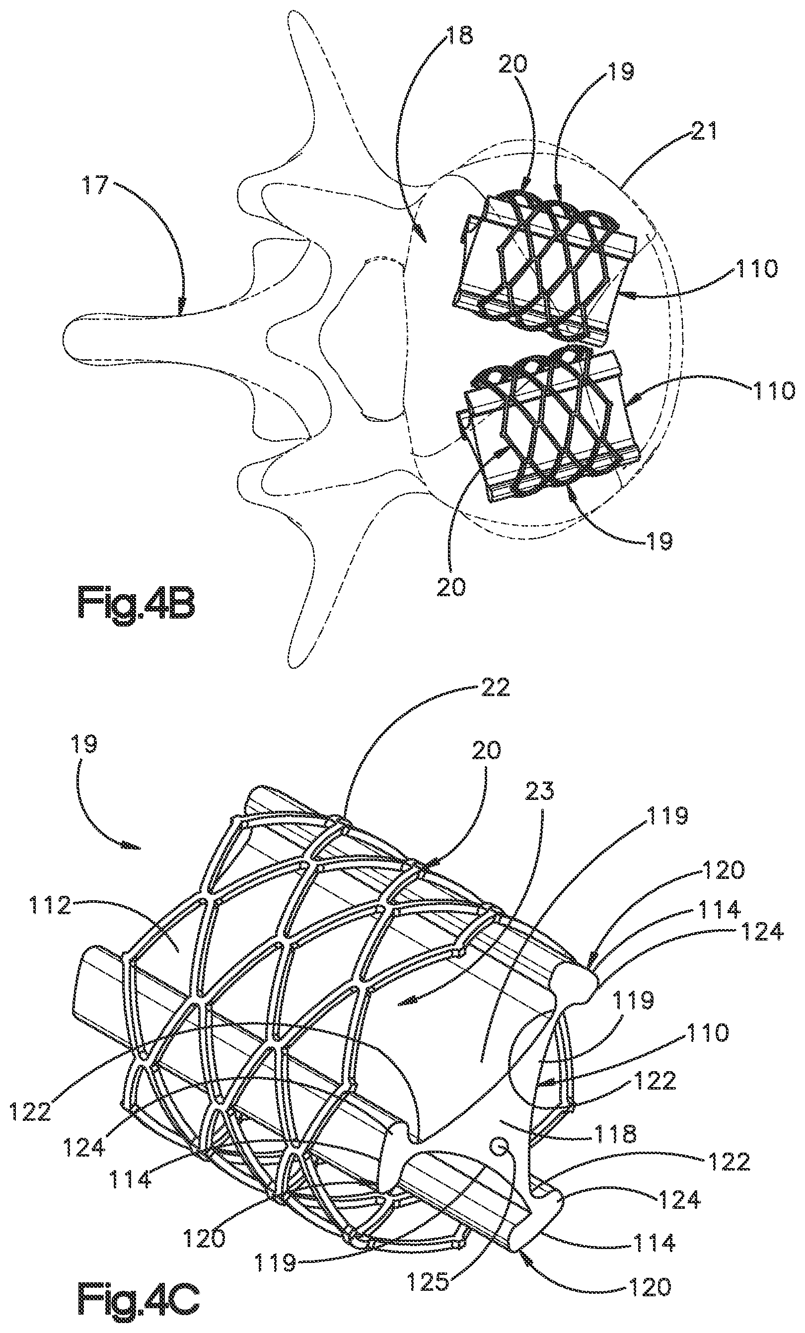 Patent US12350166 Figure 8 – Method and apparatus for augmenting bone
