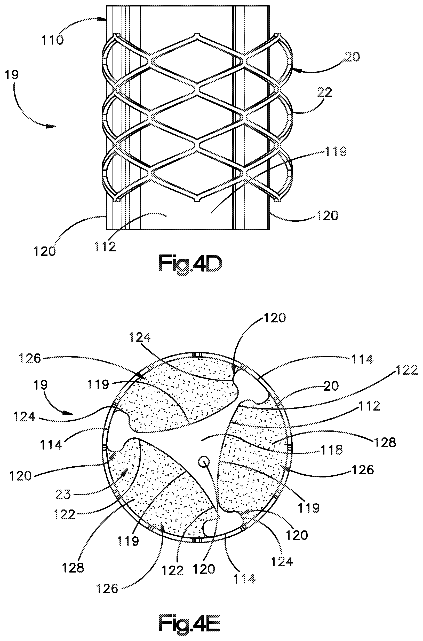 Patent US12350166 Figure 9 – Method and apparatus for augmenting bone