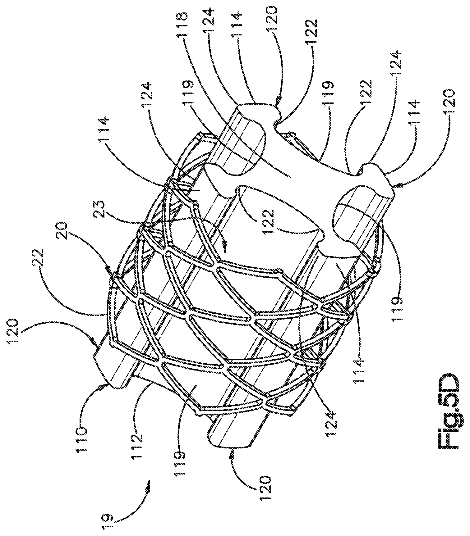 Patent US12350166 Figure 13 – Method and apparatus for augmenting bone